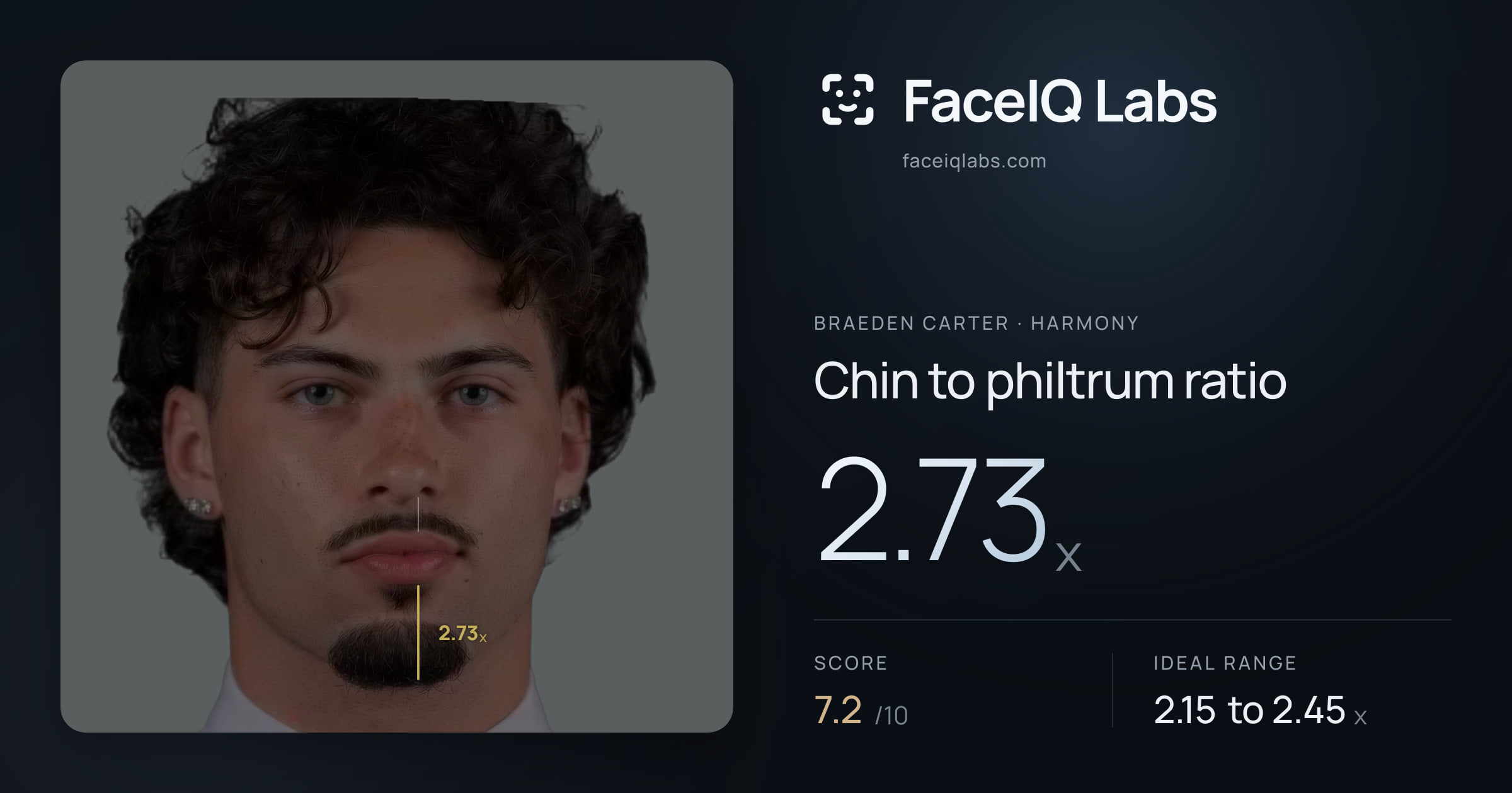 Braeden Carter Chin to philtrum ratio: 2.73x, drawn on the photo