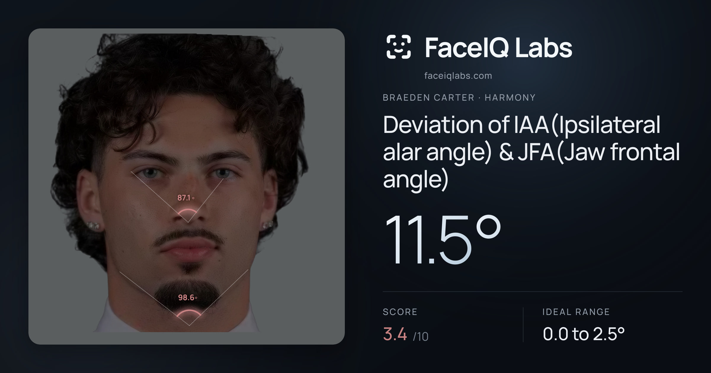 Braeden Carter Deviation of IAA(Ipsilateral alar angle) & JFA(Jaw frontal angle): 11.5°, drawn on the photo