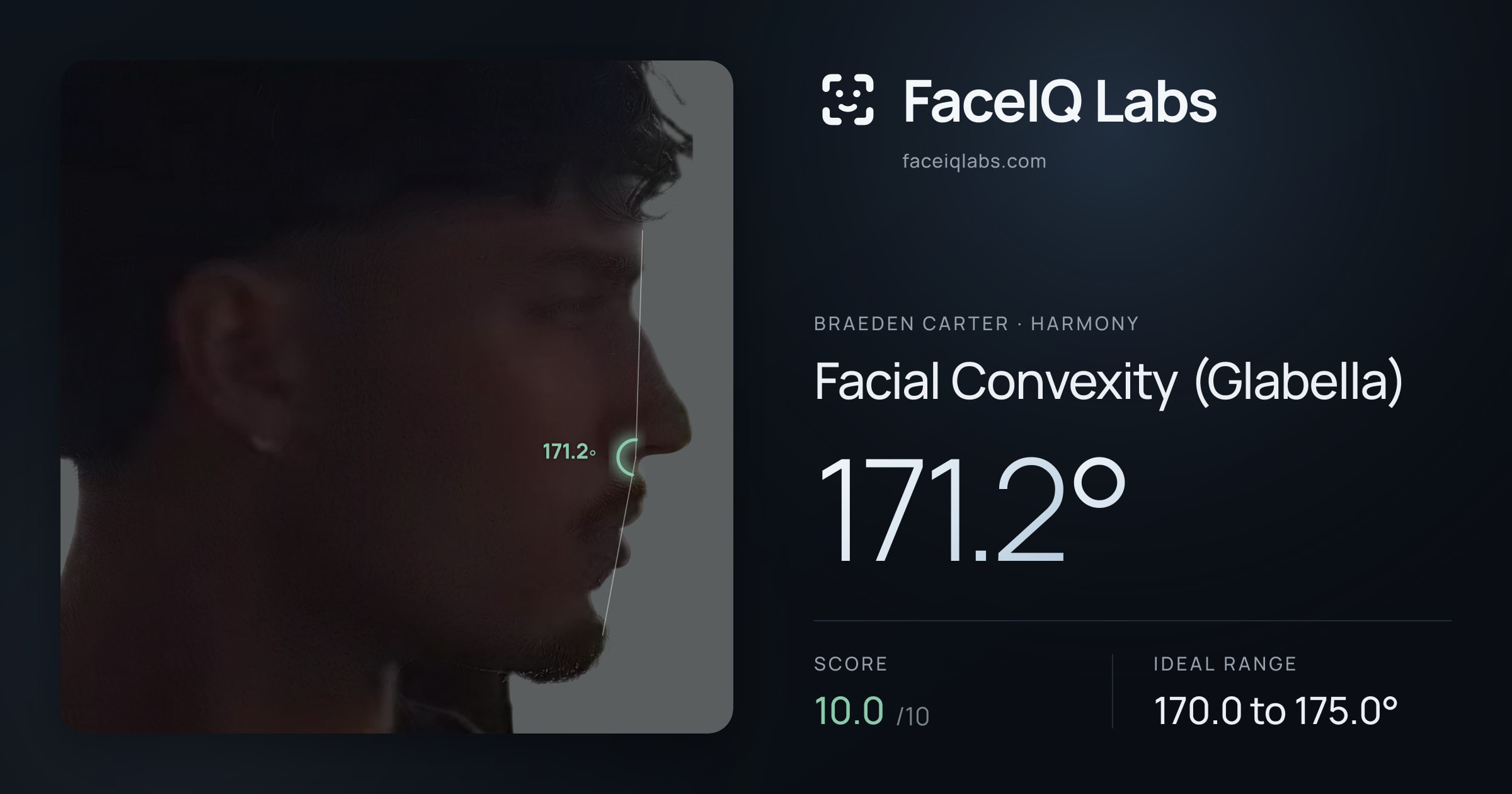 Braeden Carter Facial Convexity (Glabella): 171.2°, drawn on the photo