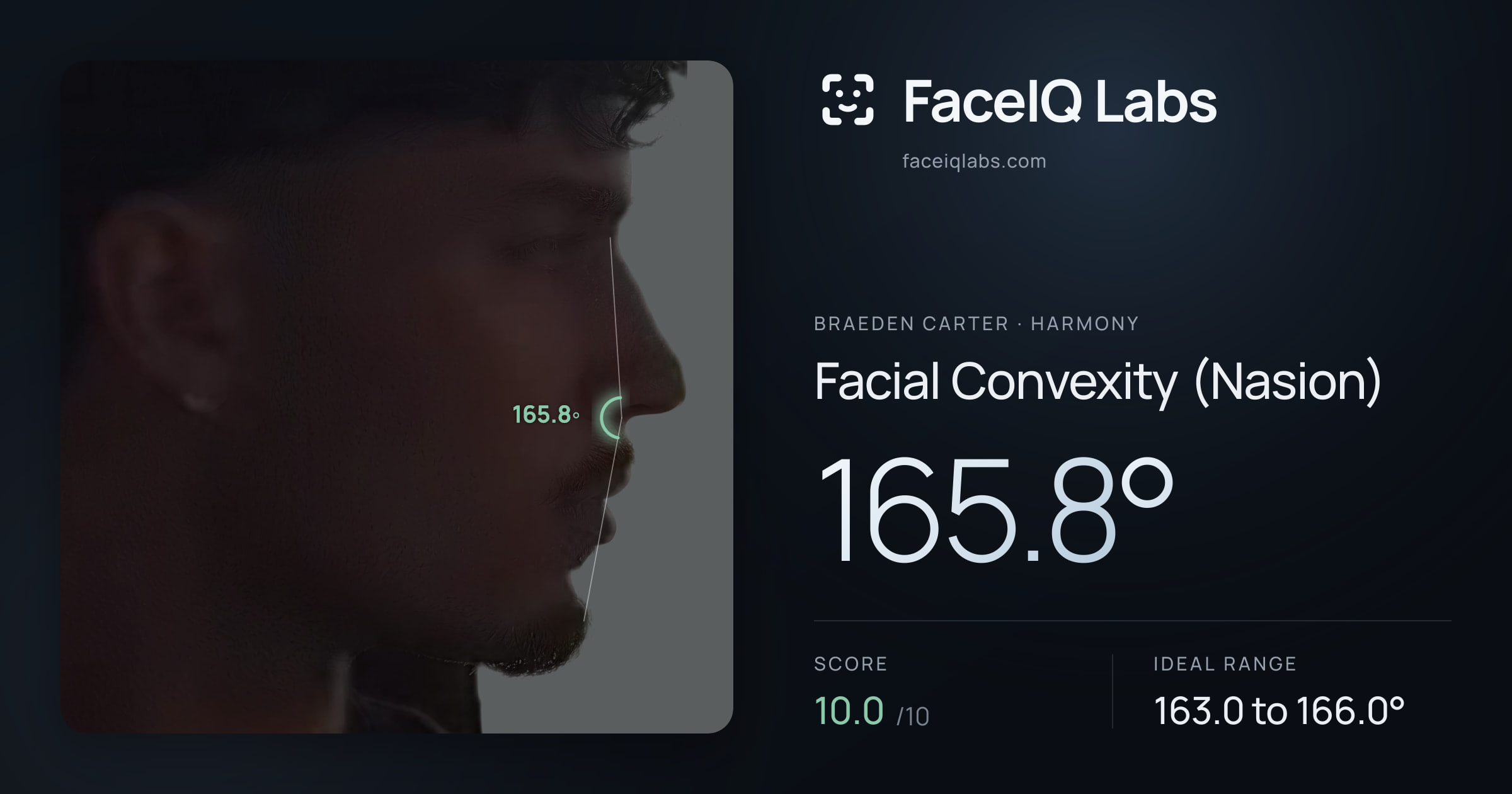 Braeden Carter Facial Convexity (Nasion): 165.8°, drawn on the photo