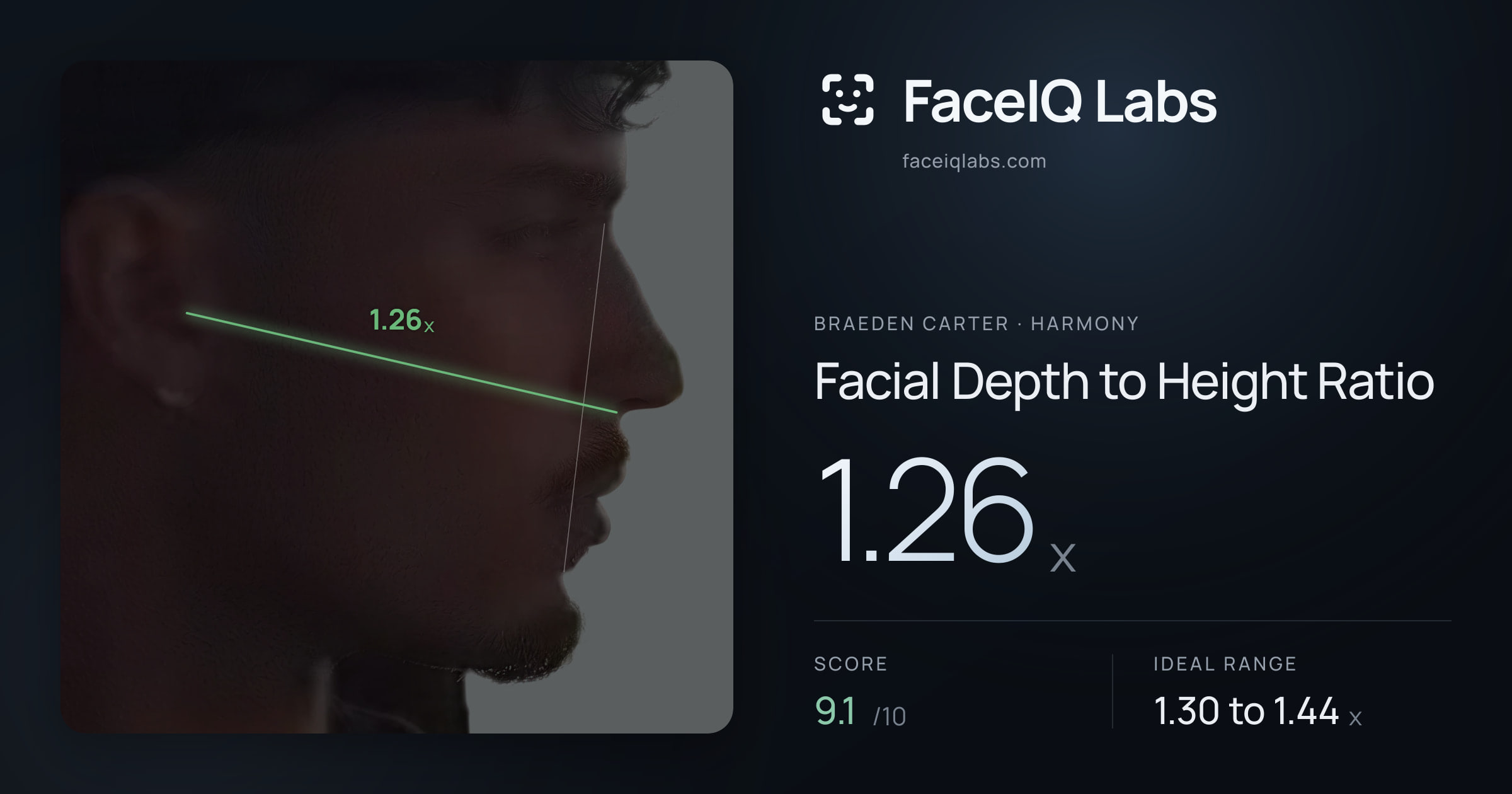 Braeden Carter Facial Depth to Height Ratio: 1.26x, drawn on the photo