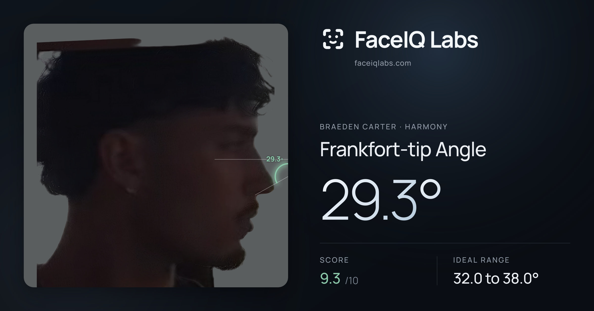 Braeden Carter Frankfort-tip Angle: 29.3°, drawn on the photo