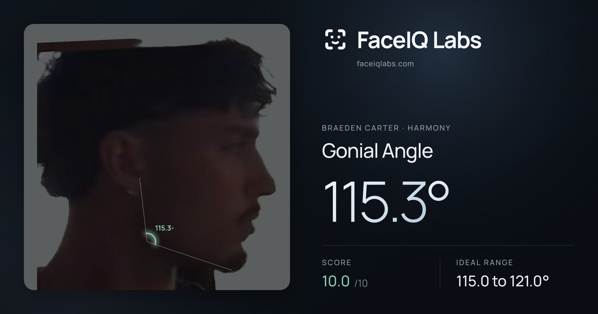Braeden Carter Gonial Angle: 115.3°, drawn on the photo