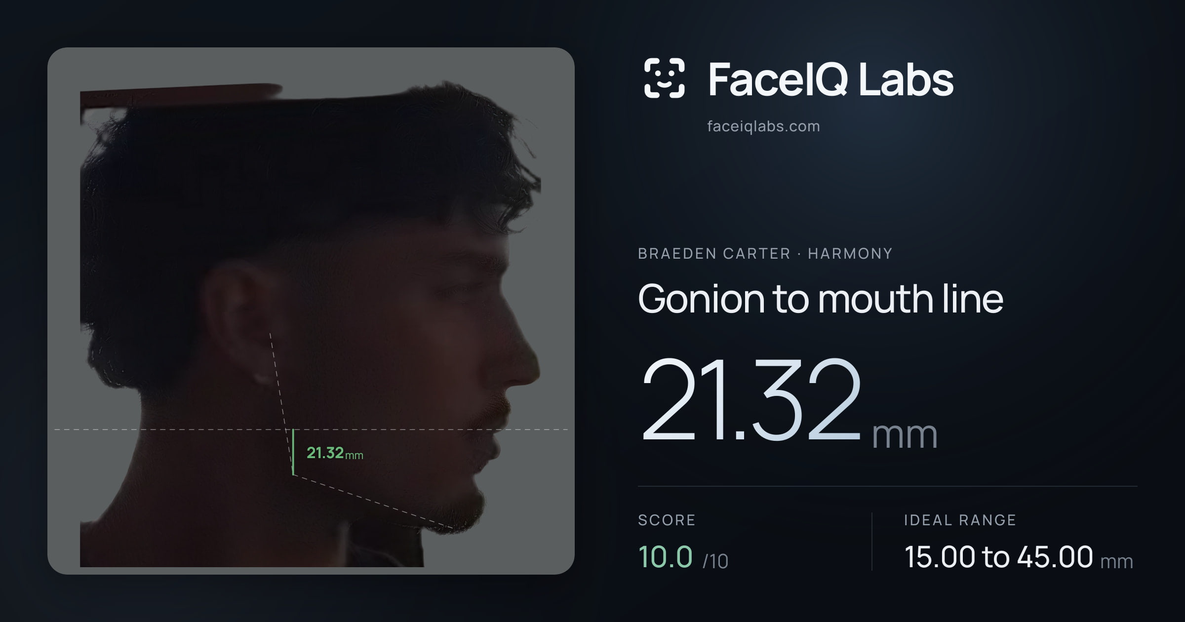 Braeden Carter Gonion to mouth line: 21.32mm, drawn on the photo