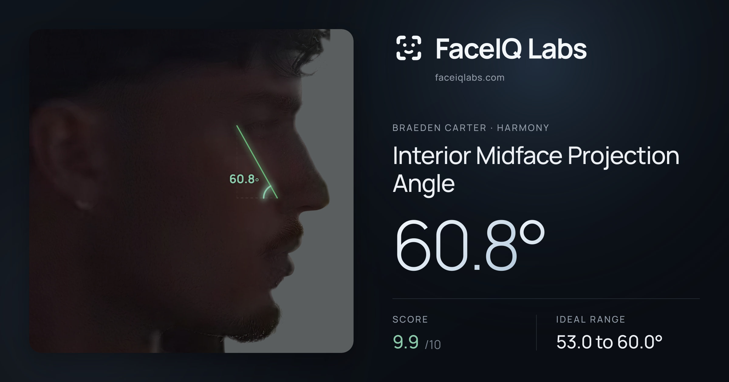 Braeden Carter Interior Midface Projection Angle: 60.8°, drawn on the photo