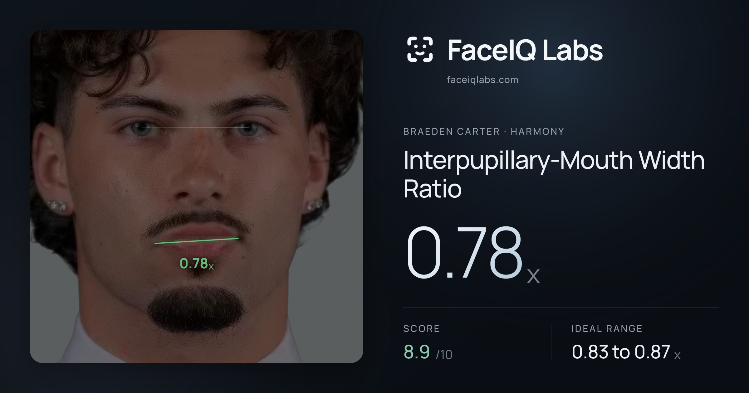 Braeden Carter Interpupillary-Mouth Width Ratio: 0.78x, drawn on the photo