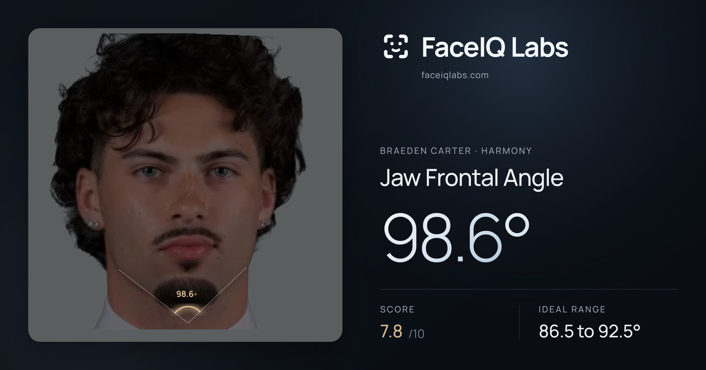 Braeden Carter Jaw Frontal Angle: 98.6°, drawn on the photo