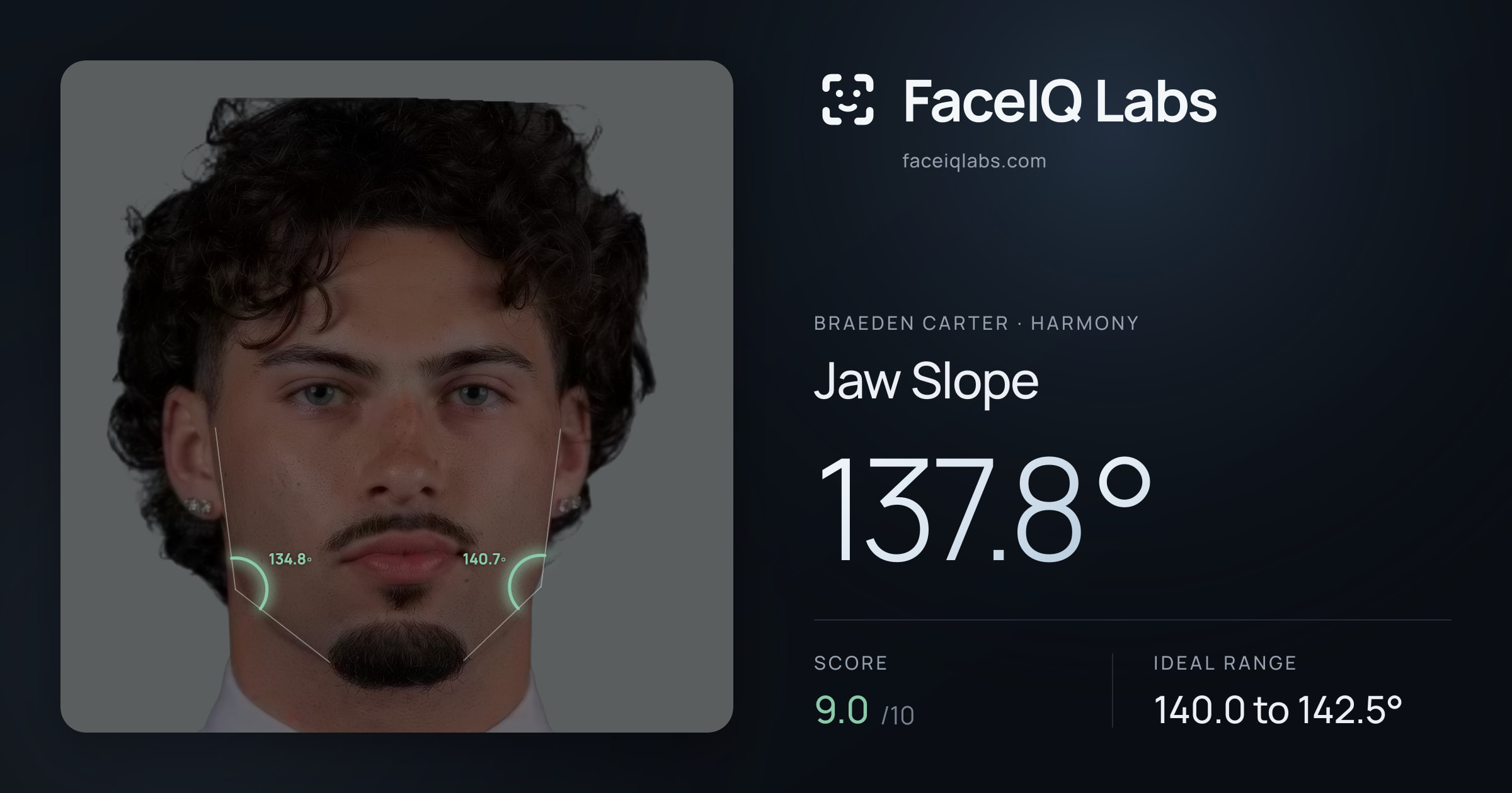 Braeden Carter Jaw Slope: 137.8°, drawn on the photo
