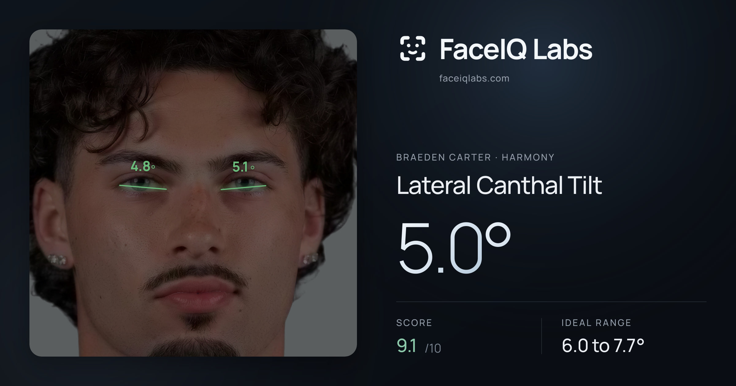Braeden Carter Lateral Canthal Tilt: 5.0°, drawn on the photo