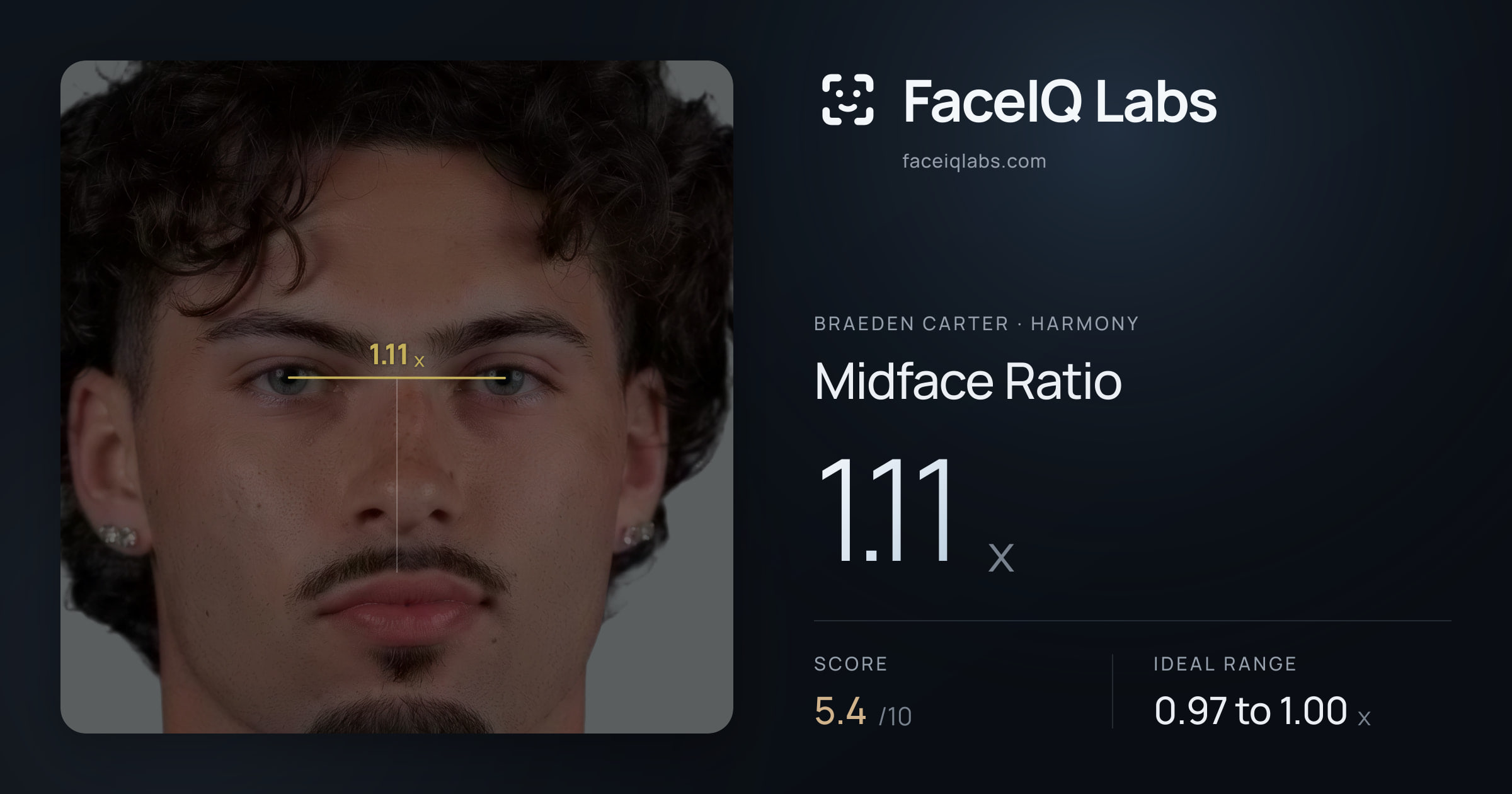 Braeden Carter Midface Ratio: 1.11x, drawn on the photo