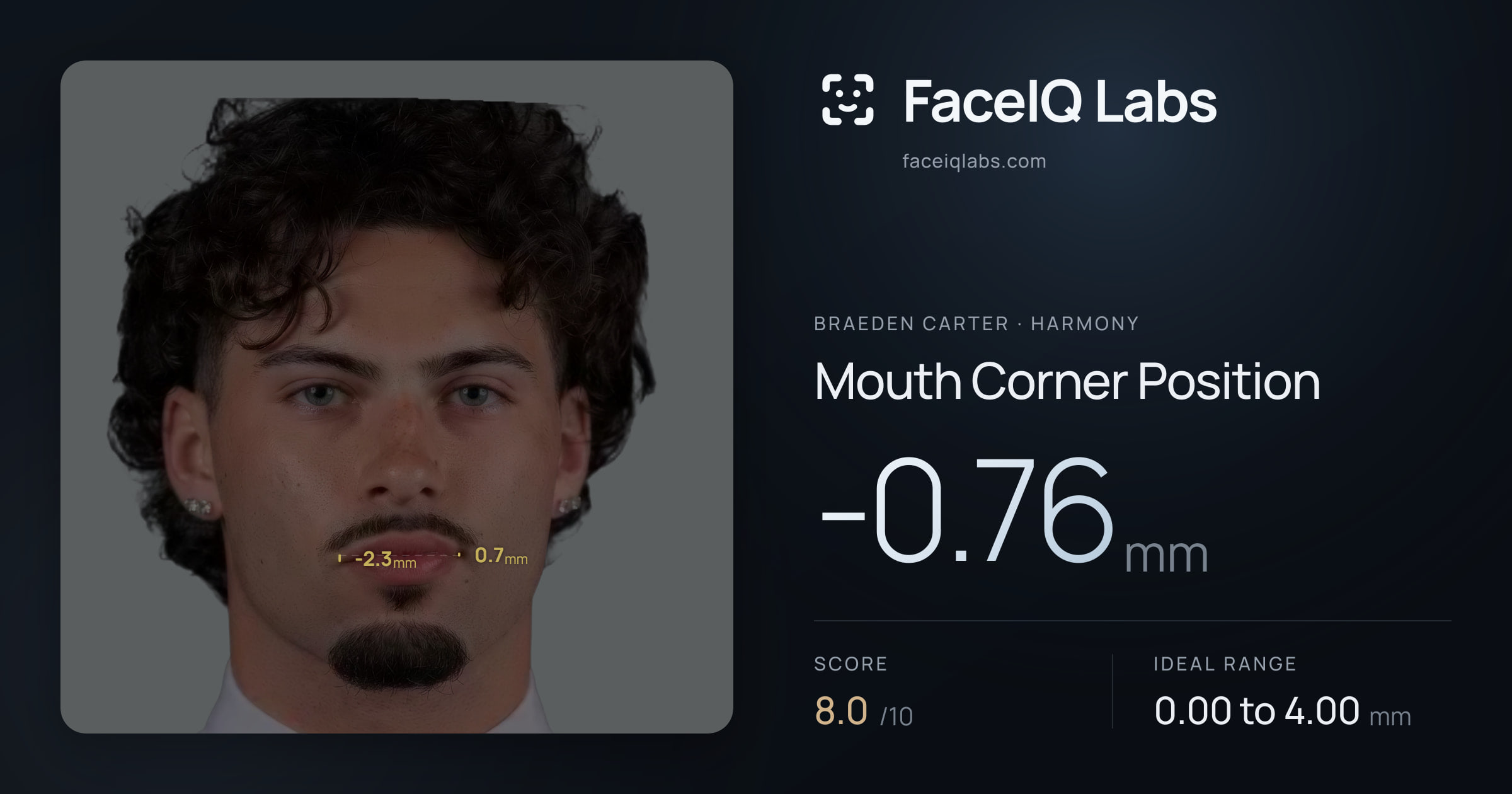 Braeden Carter Mouth Corner Position: -0.76mm, drawn on the photo