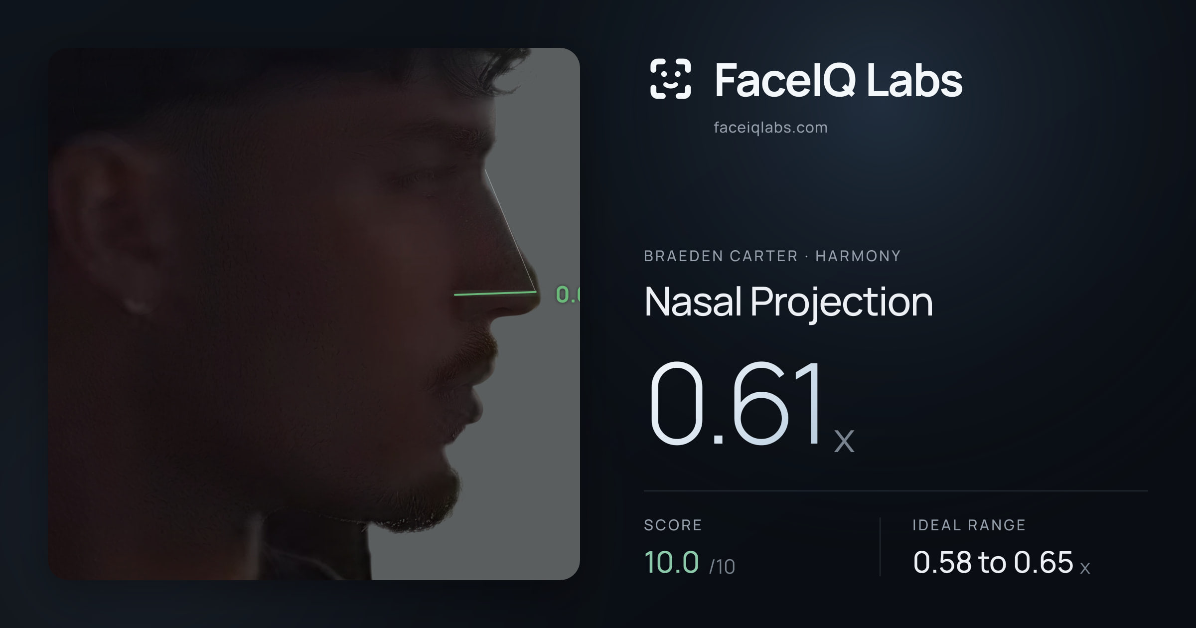 Braeden Carter Nasal Projection: 0.61x, drawn on the photo