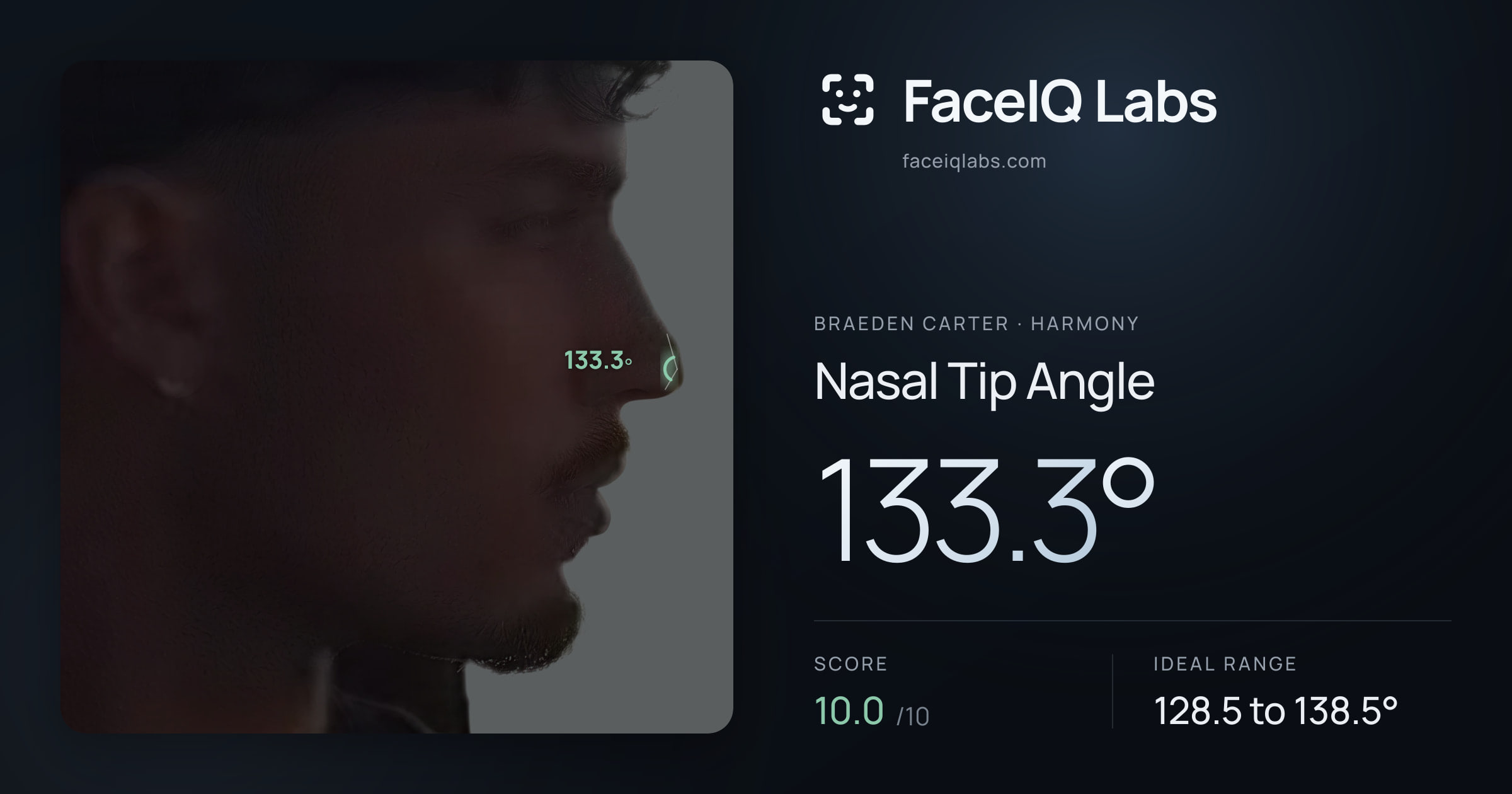 Braeden Carter Nasal Tip Angle: 133.3°, drawn on the photo