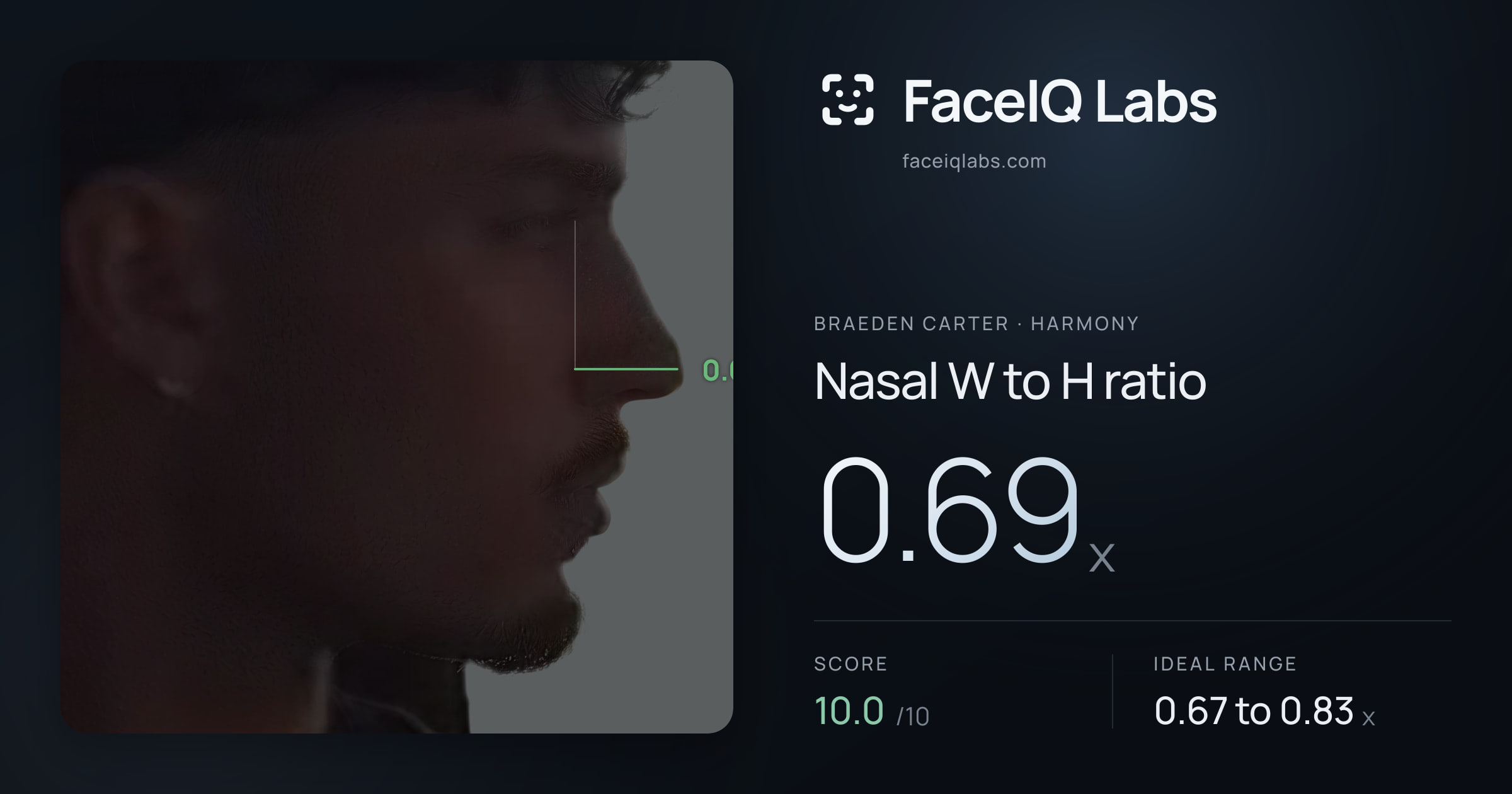 Braeden Carter Nasal W to H ratio: 0.69x, drawn on the photo