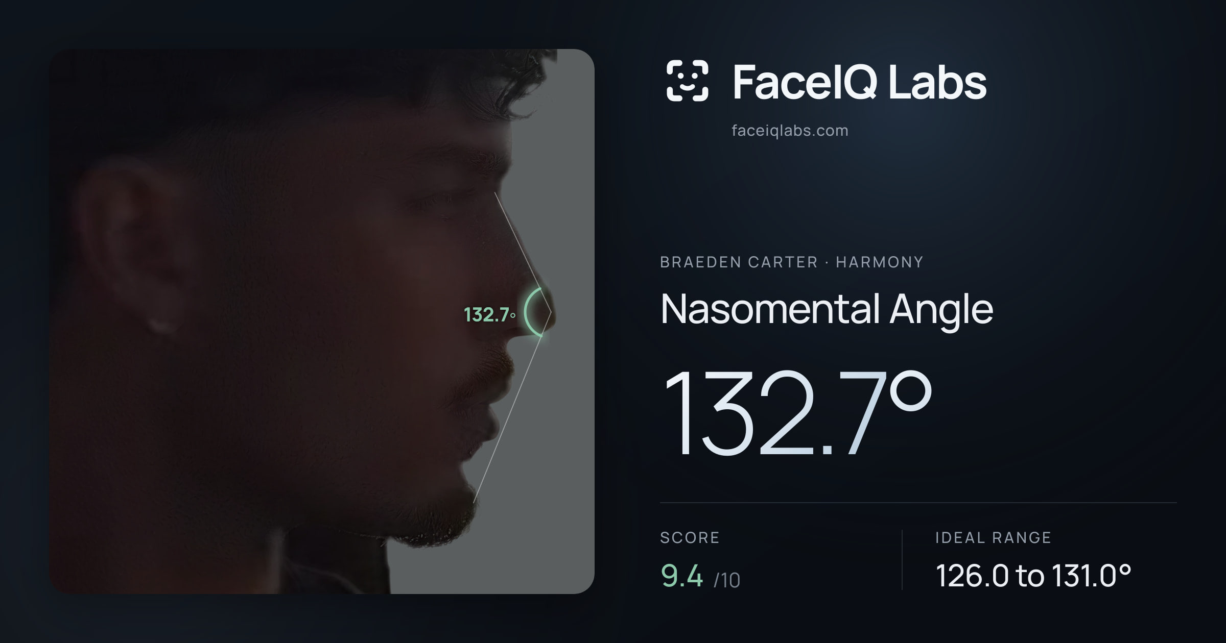 Braeden Carter Nasomental Angle: 132.7°, drawn on the photo