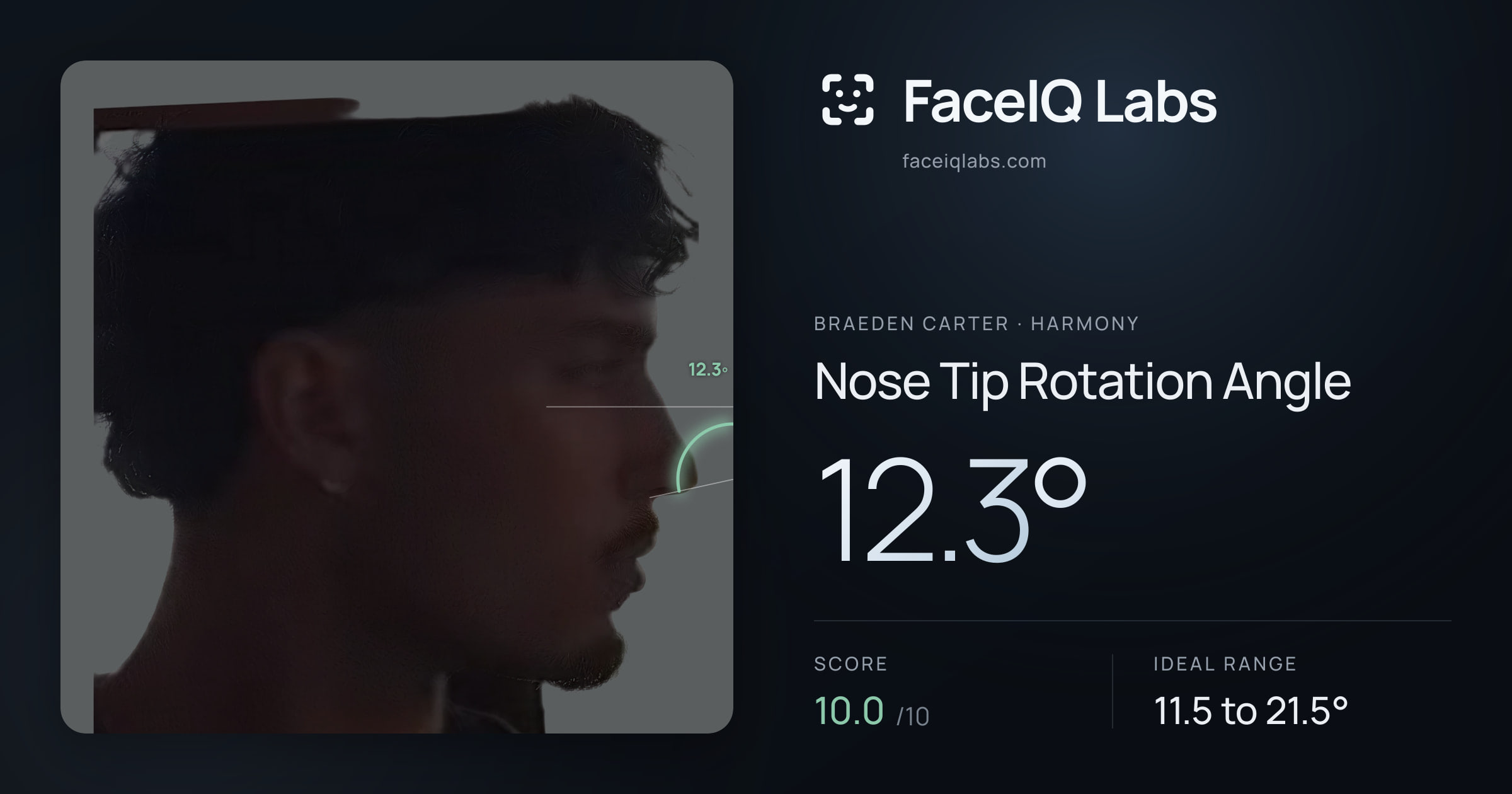 Braeden Carter Nose Tip Rotation Angle: 12.3°, drawn on the photo