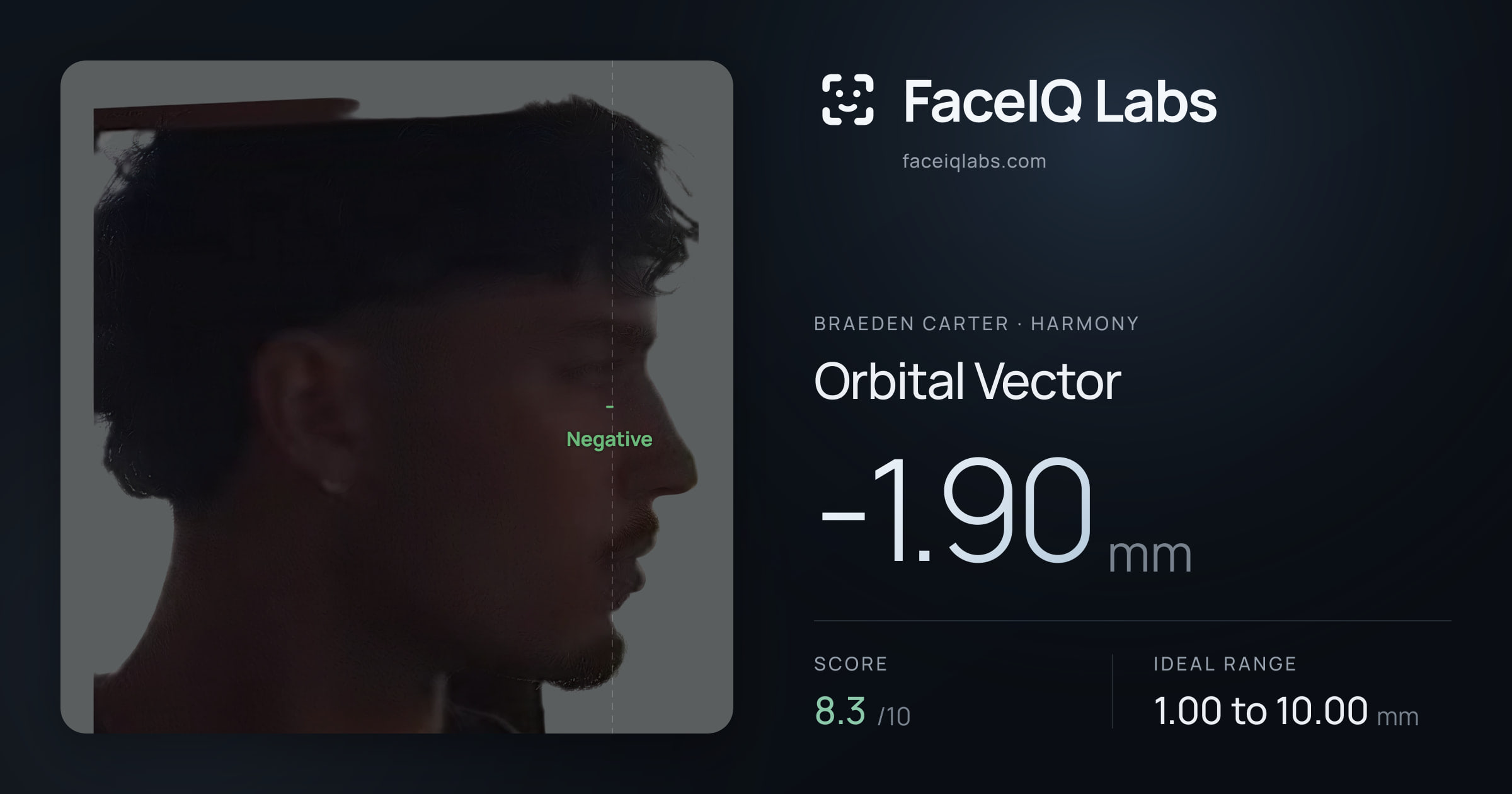 Braeden Carter Orbital Vector: -1.90mm, drawn on the photo