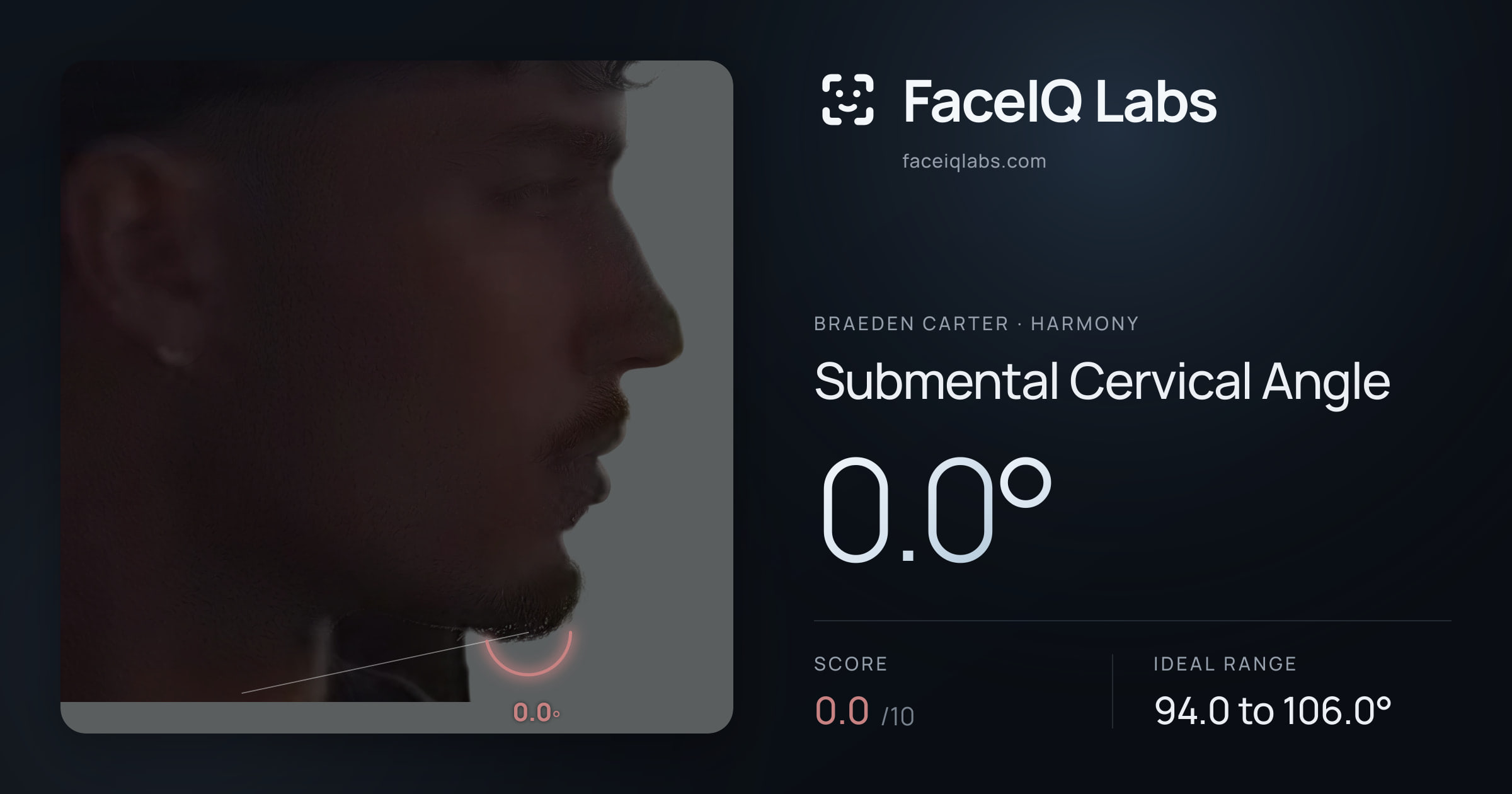 Braeden Carter Submental Cervical Angle: 0.0°, drawn on the photo