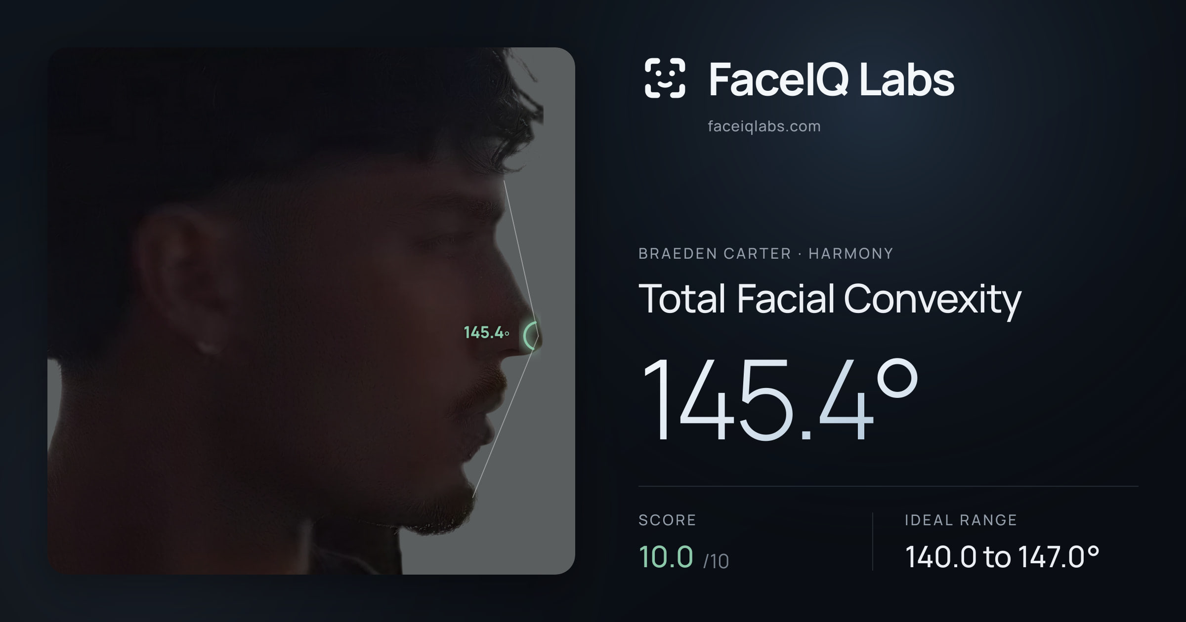 Braeden Carter Total Facial Convexity: 145.4°, drawn on the photo