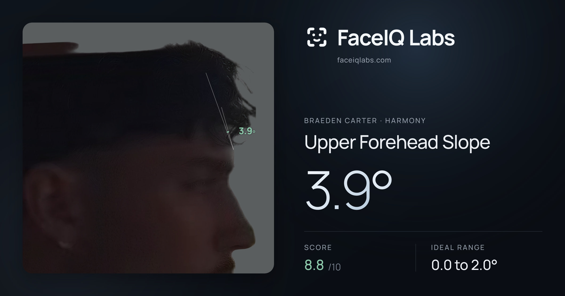 Braeden Carter Upper Forehead Slope: 3.9°, drawn on the photo