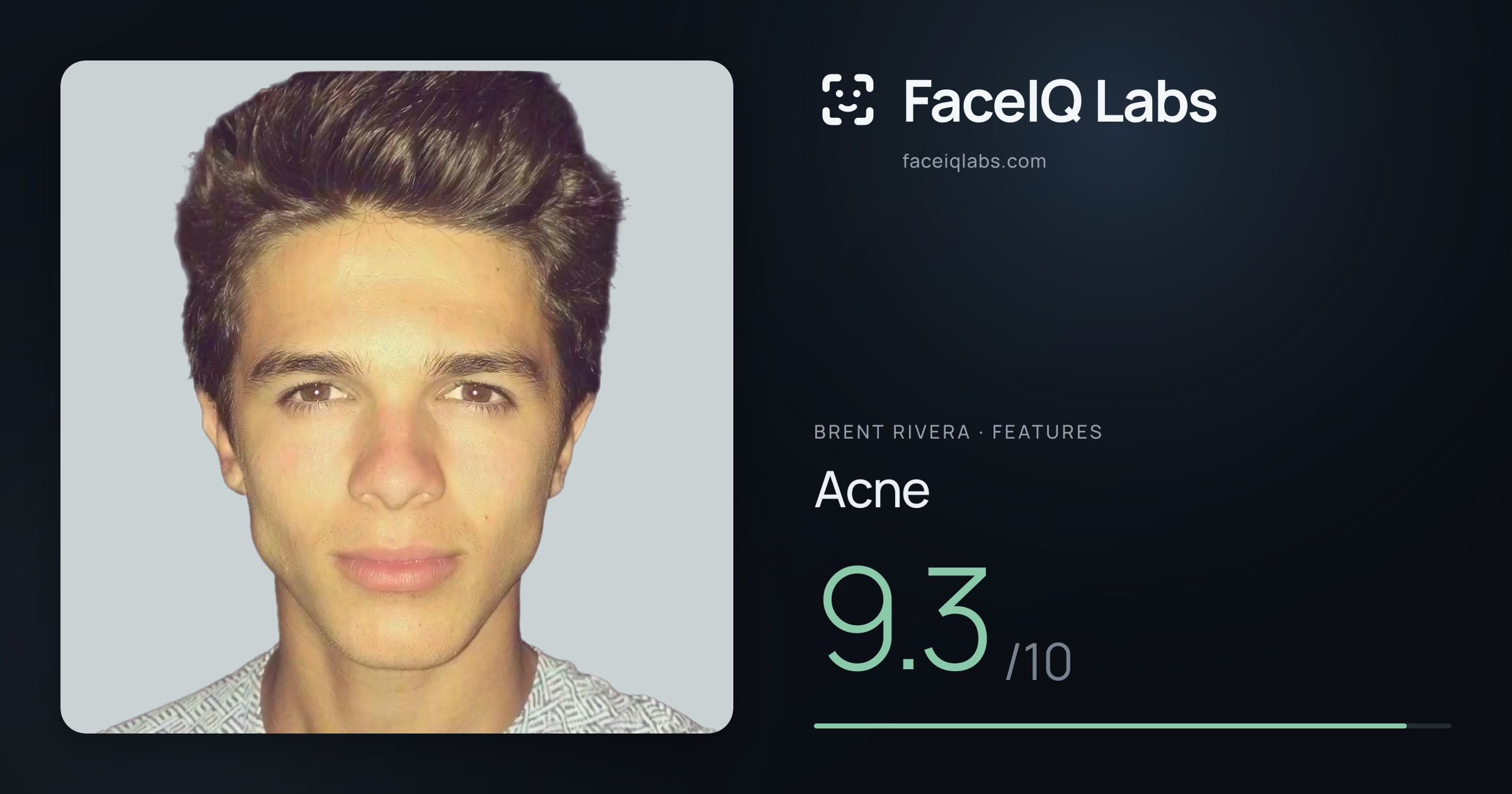 Brent Rivera Acne: 9.3/10, drawn on the photo