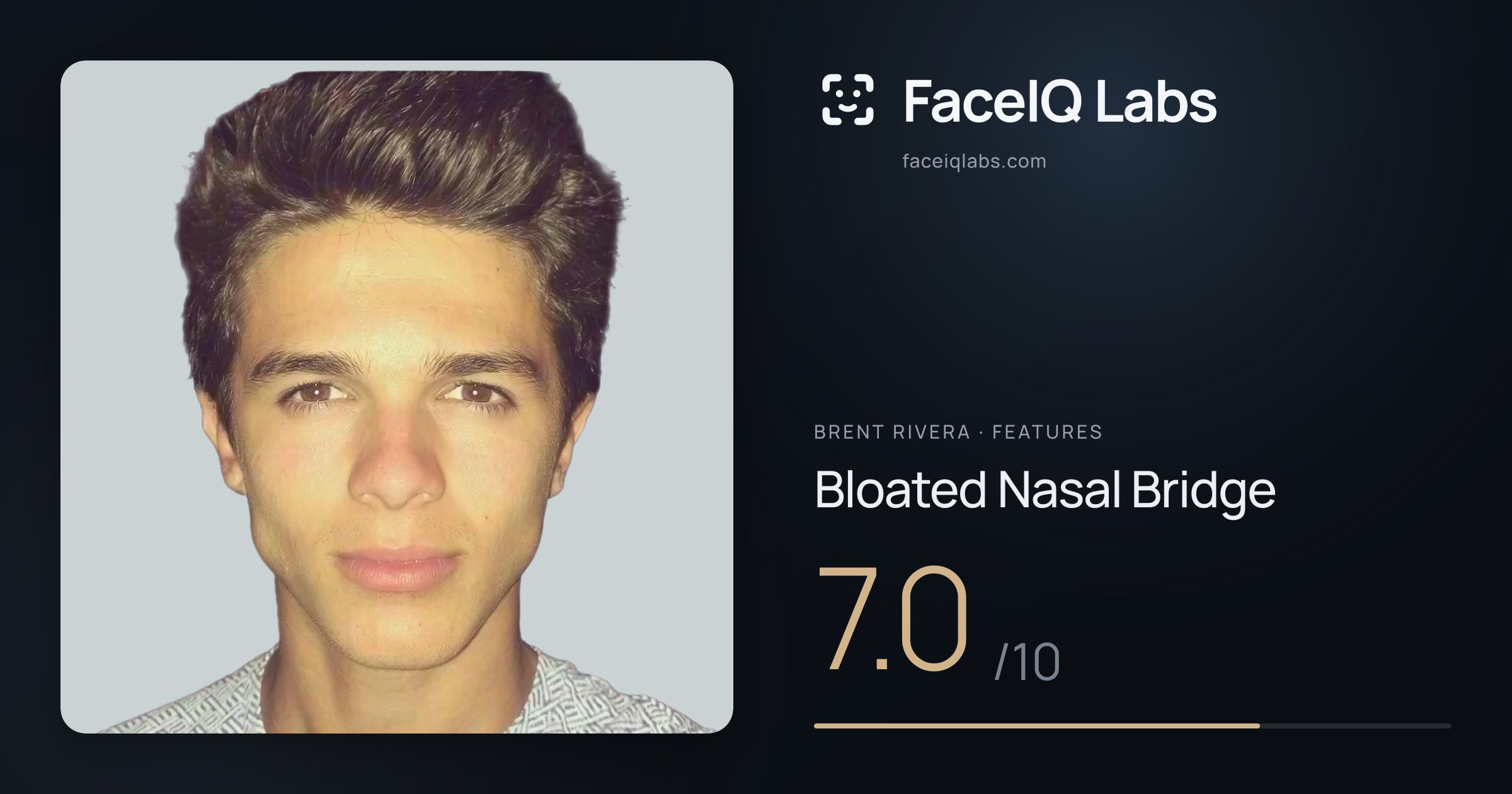 Brent Rivera Bloated Nasal Bridge: 7.0/10, drawn on the photo