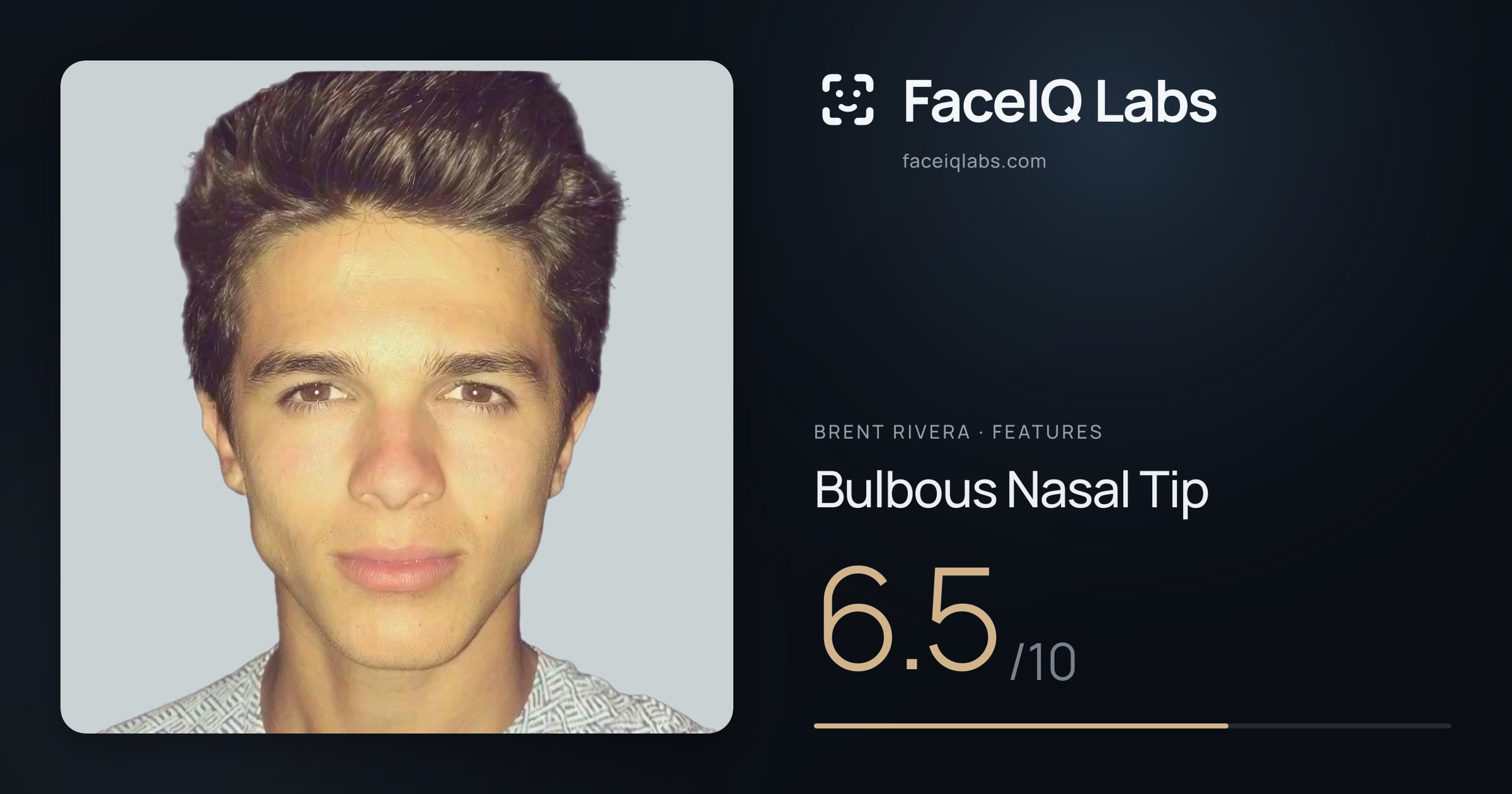 Brent Rivera Bulbous Nasal Tip: 6.5/10, drawn on the photo