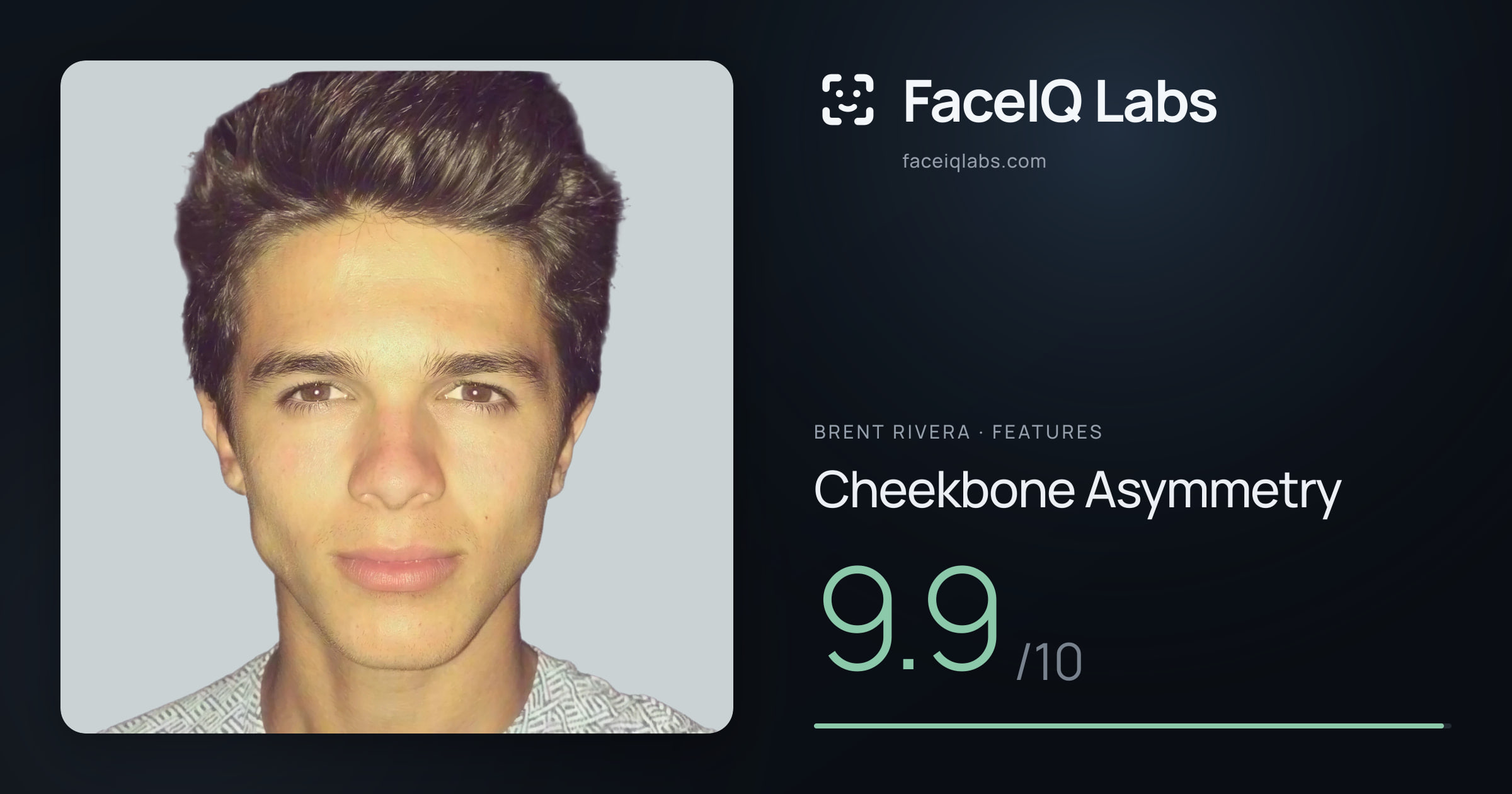 Brent Rivera Cheekbone Asymmetry: 9.9/10, drawn on the photo