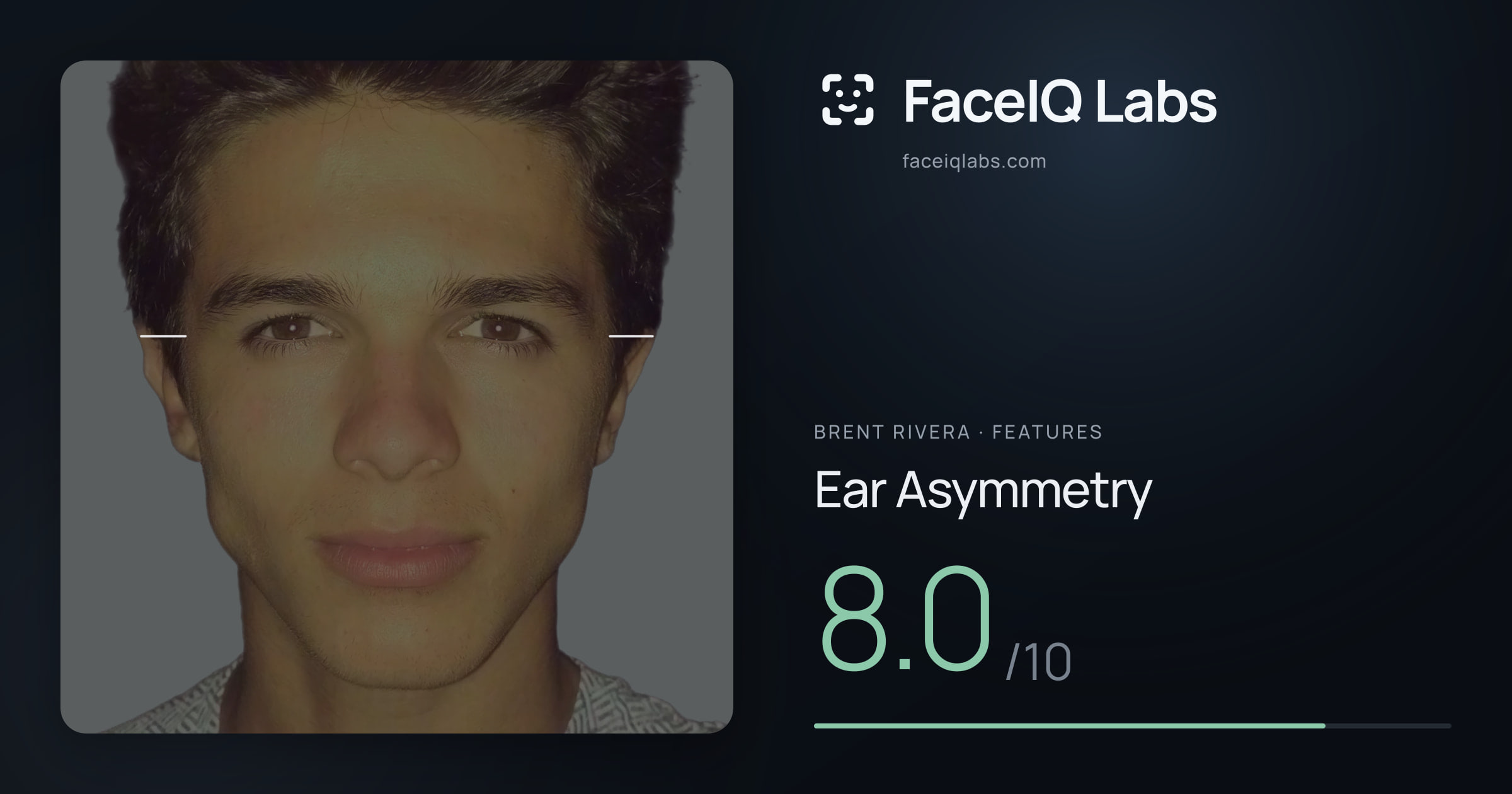 Brent Rivera Ear Asymmetry: 8.0/10, drawn on the photo