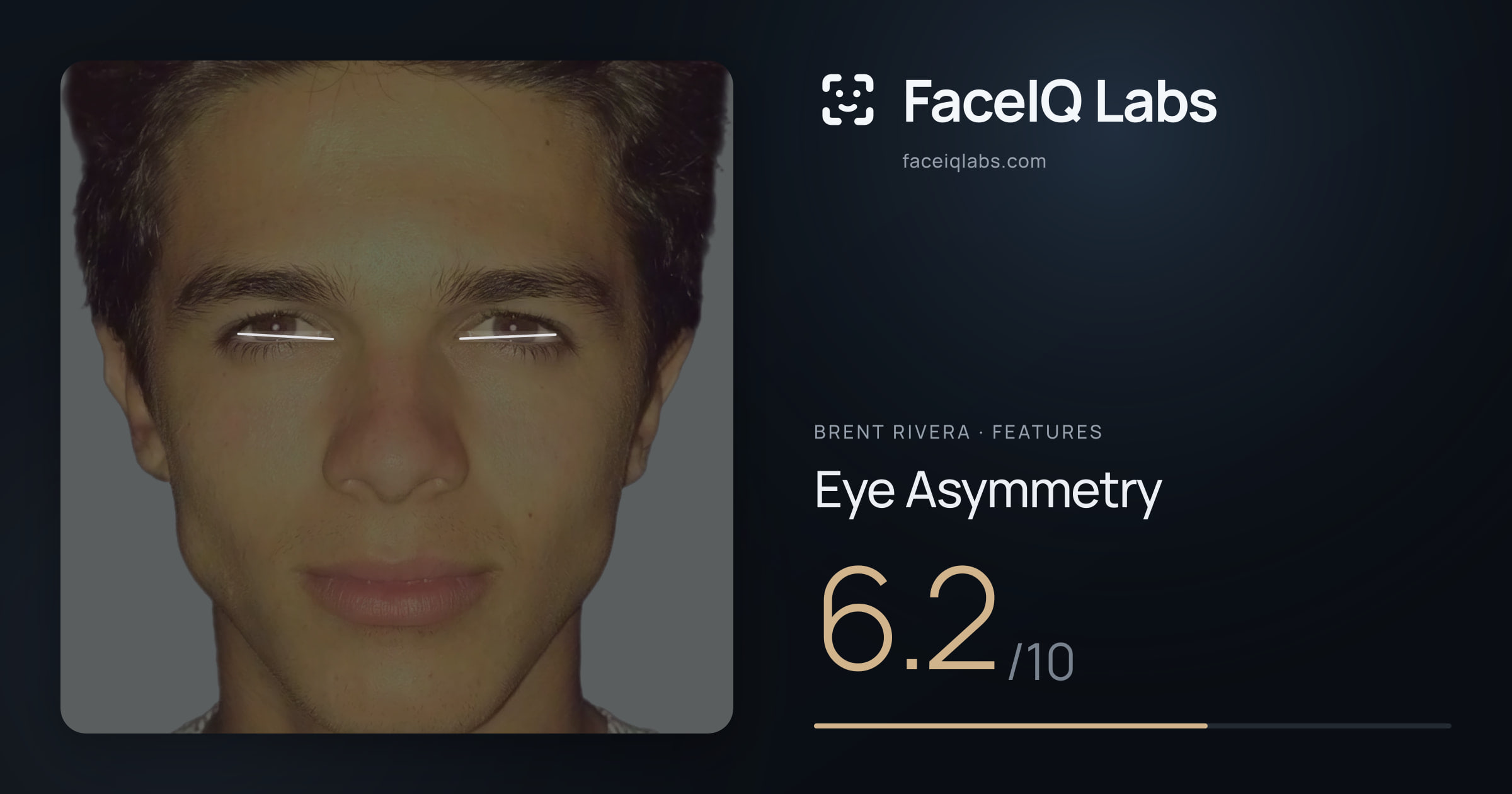 Brent Rivera Eye Asymmetry: 6.2/10, drawn on the photo
