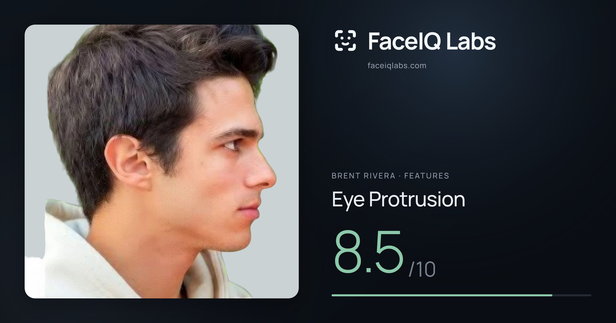 Brent Rivera Eye Protrusion: 8.5/10, drawn on the photo