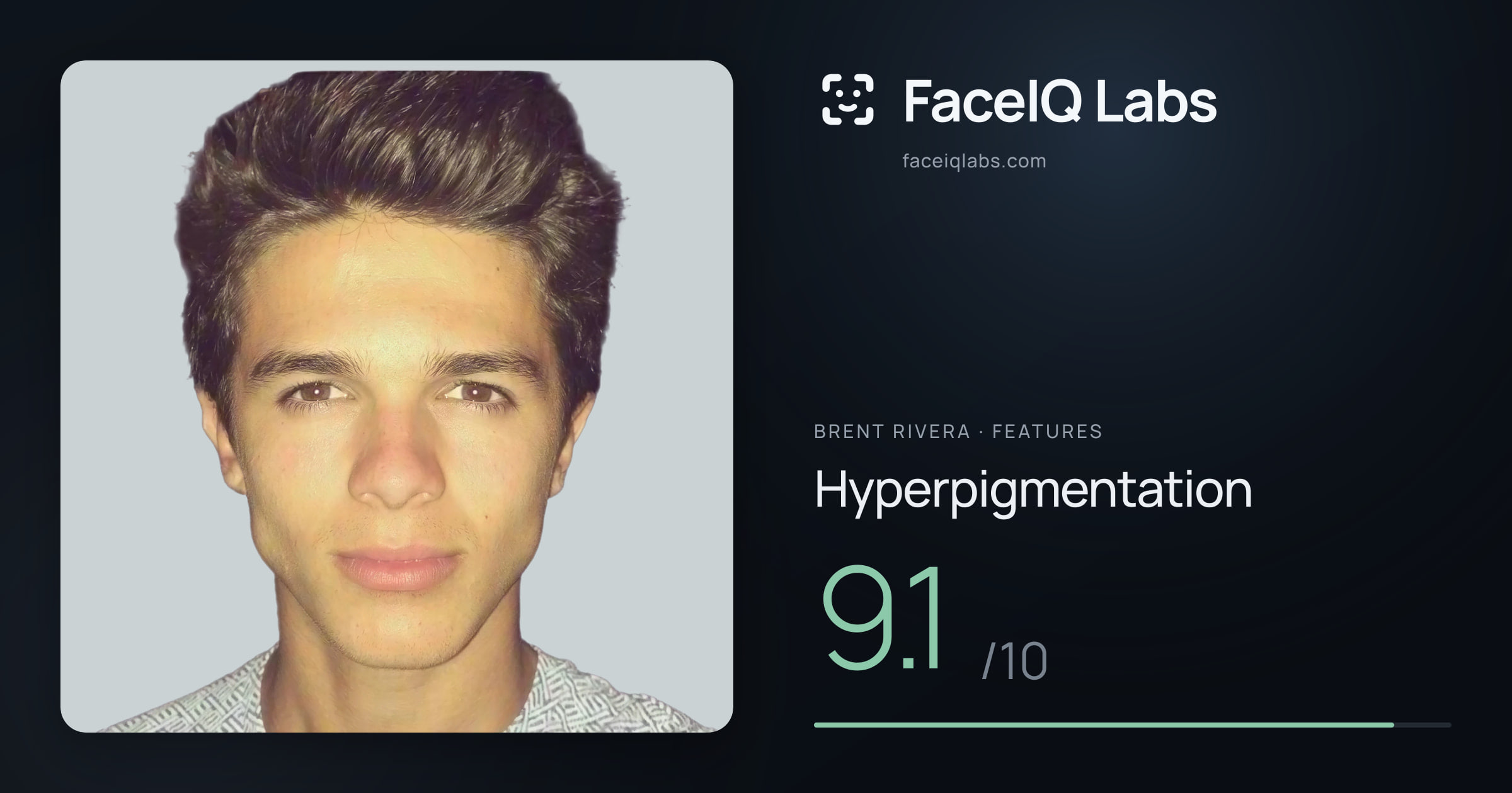 Brent Rivera Hyperpigmentation: 9.1/10, drawn on the photo