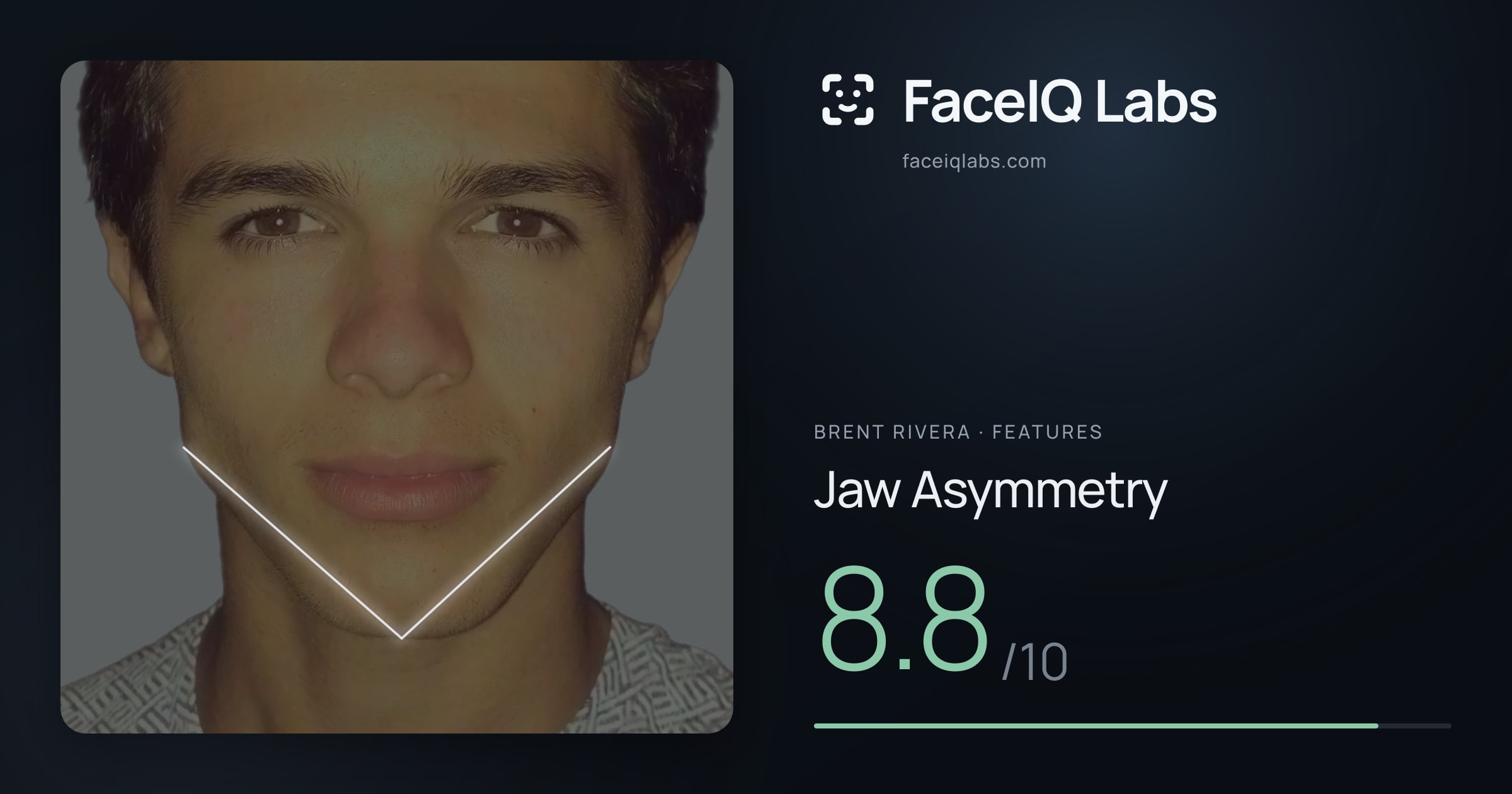 Brent Rivera Jaw Asymmetry: 8.8/10, drawn on the photo