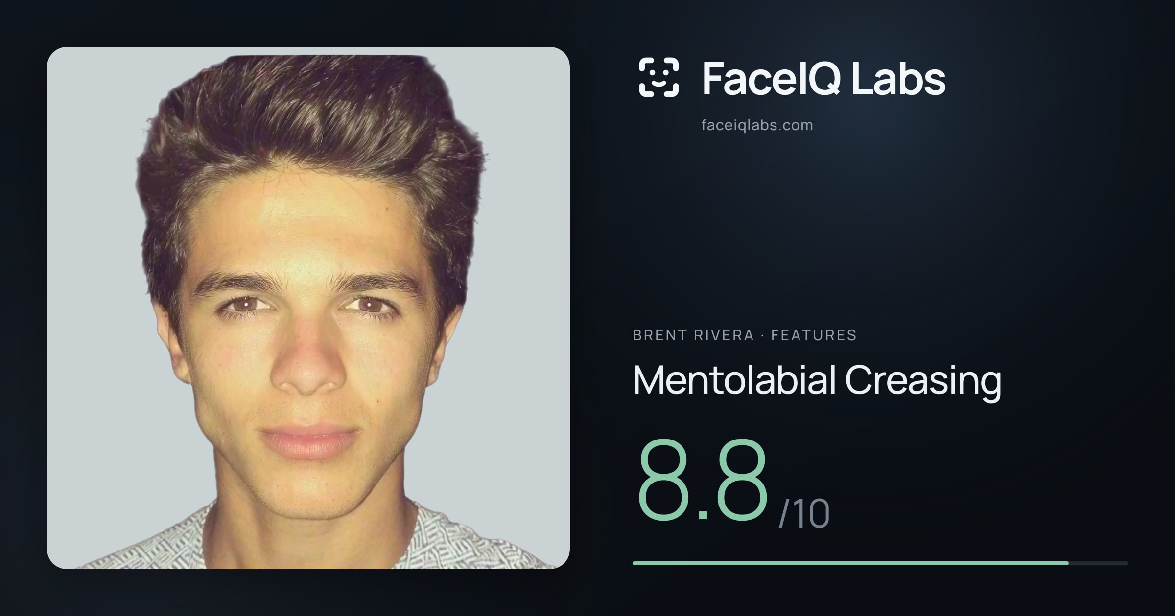Brent Rivera Mentolabial Creasing: 8.8/10, drawn on the photo