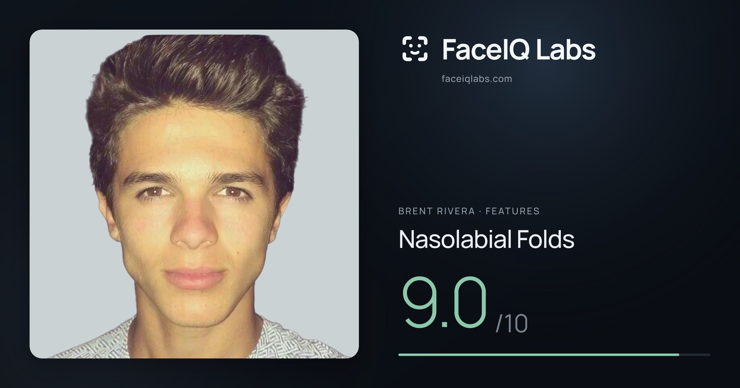 Brent Rivera Nasolabial Folds: 9.0/10, drawn on the photo