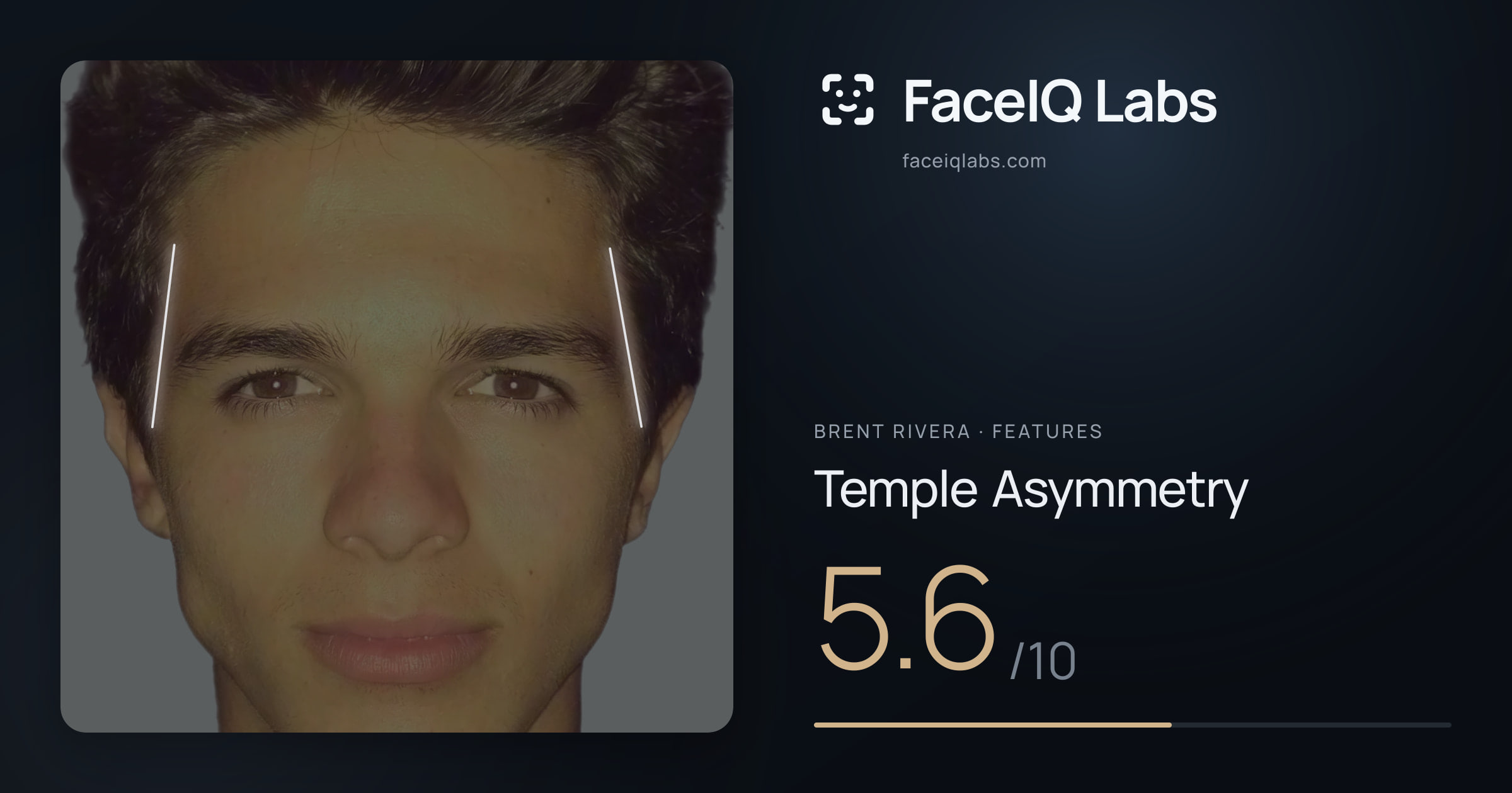 Brent Rivera Temple Asymmetry: 5.6/10, drawn on the photo