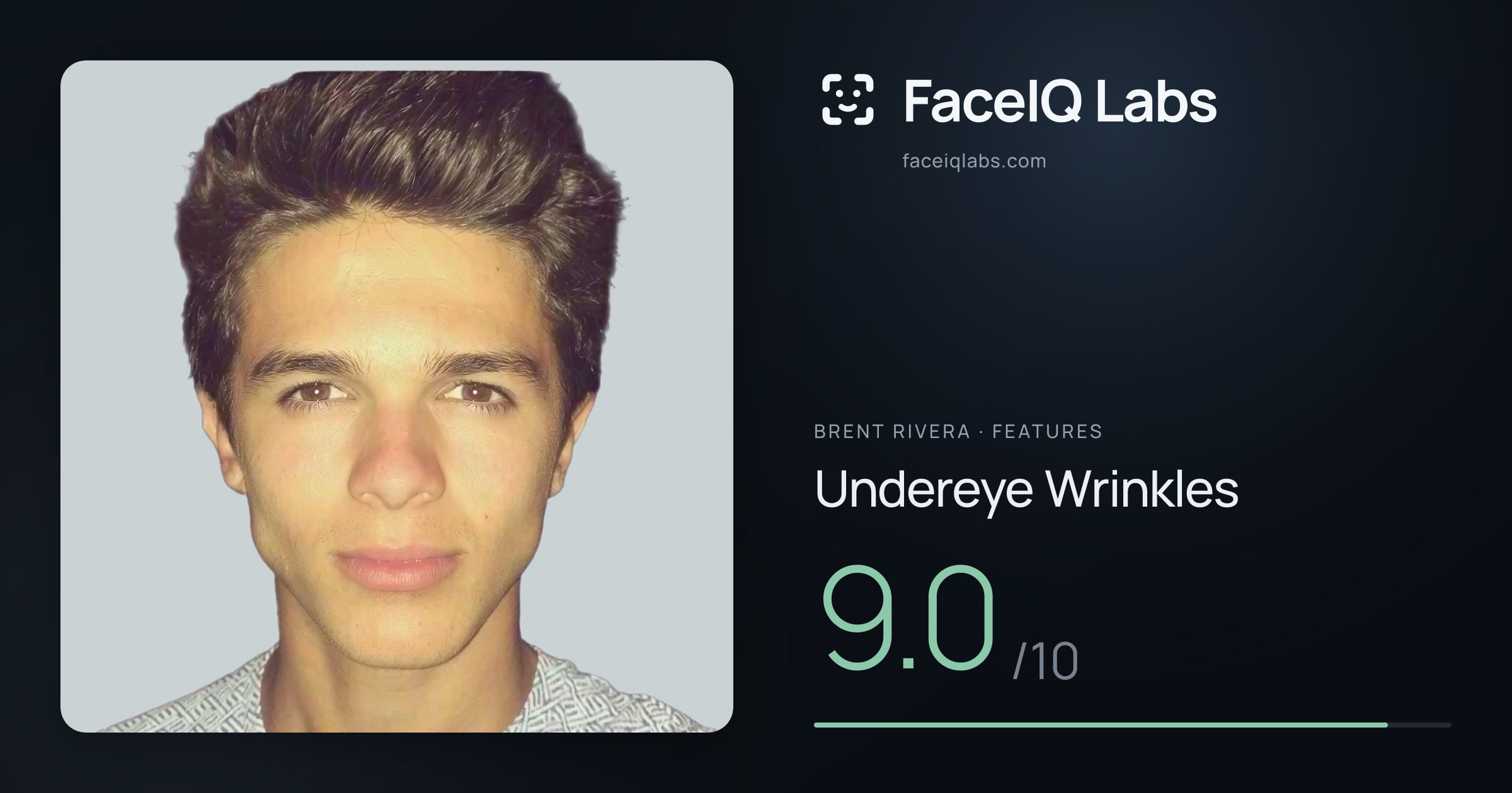Brent Rivera Undereye Wrinkles: 9.0/10, drawn on the photo