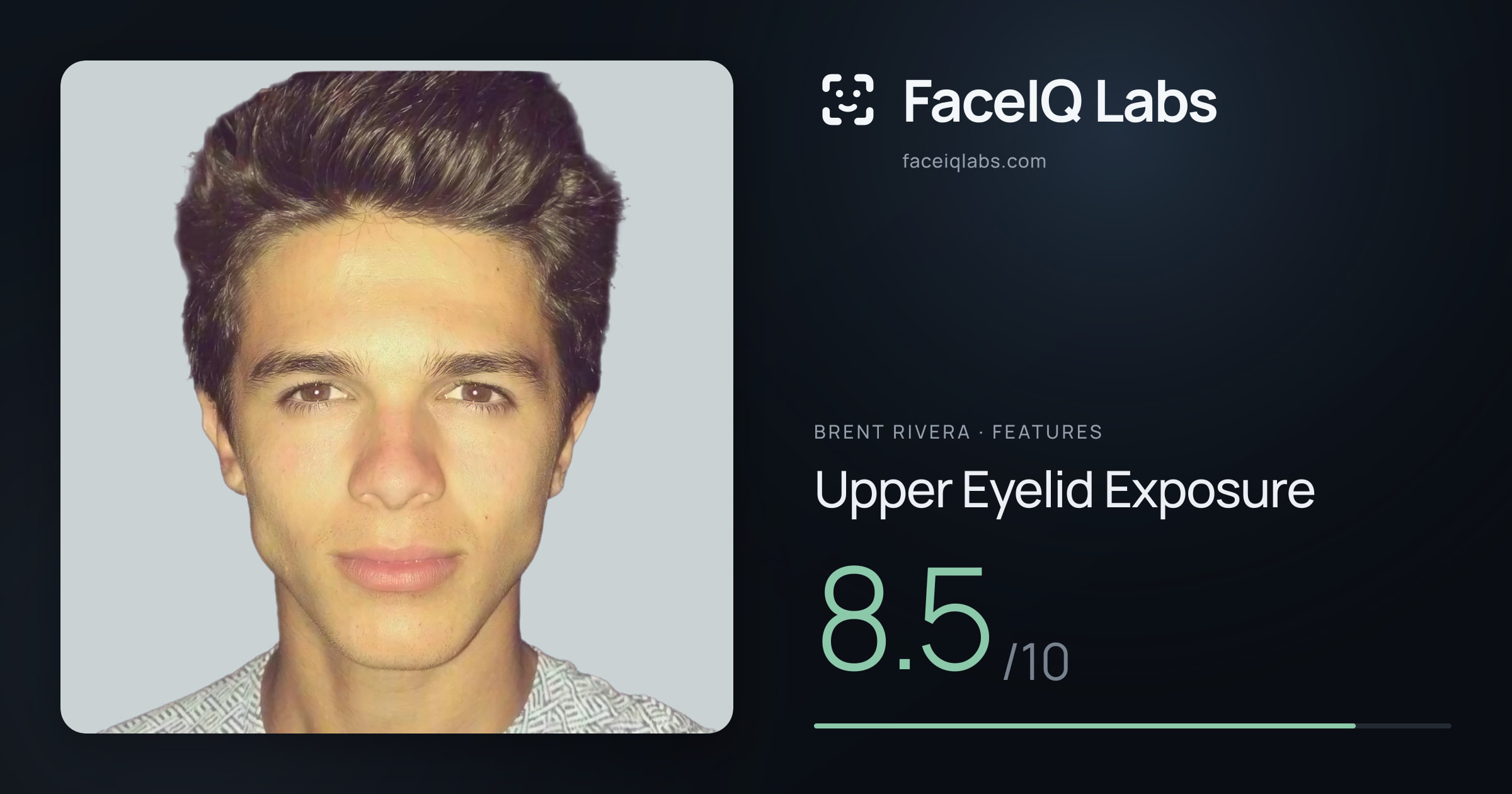Brent Rivera Upper Eyelid Exposure: 8.5/10, drawn on the photo