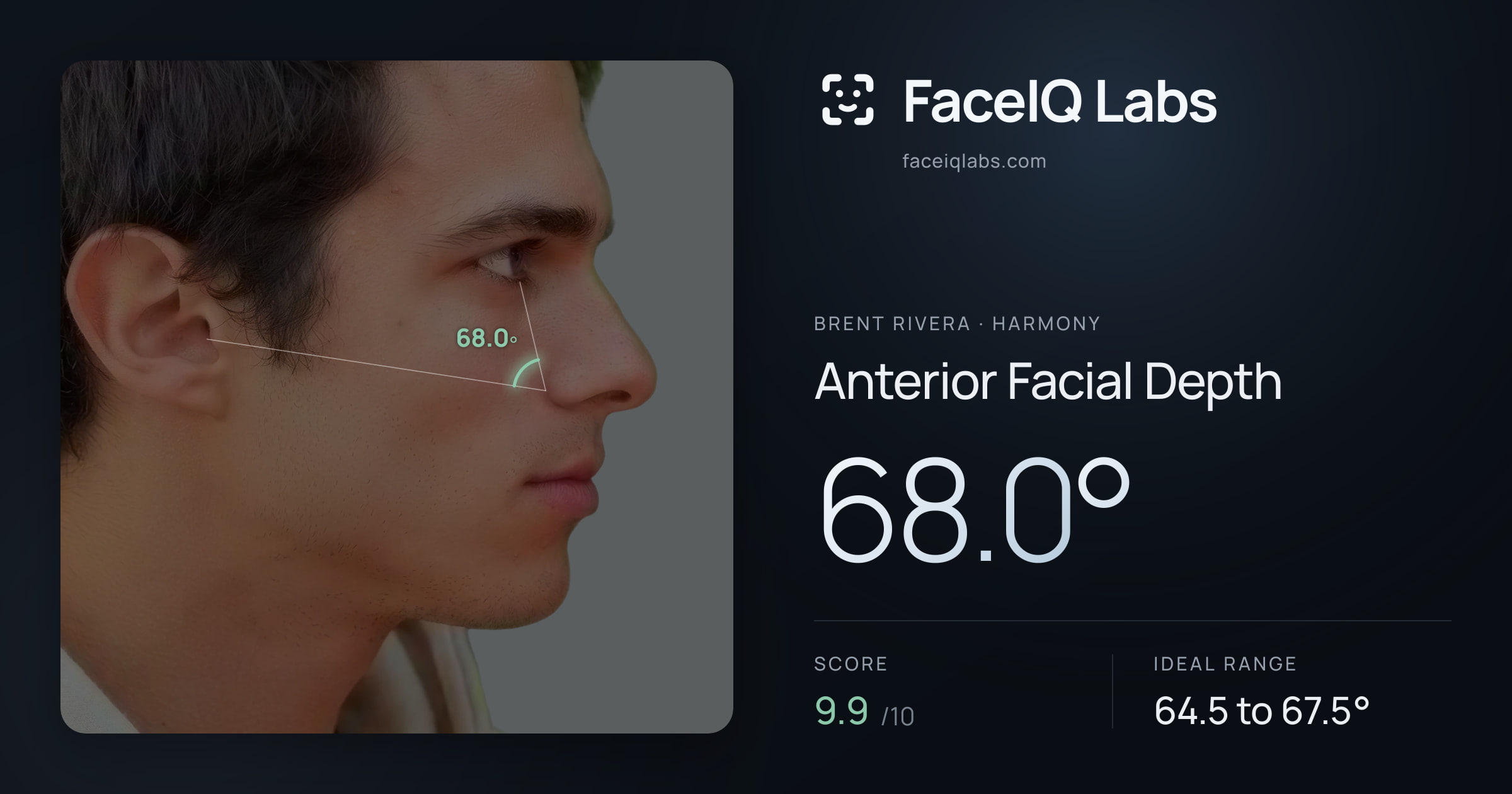 Brent Rivera Anterior Facial Depth: 68.0°, drawn on the photo