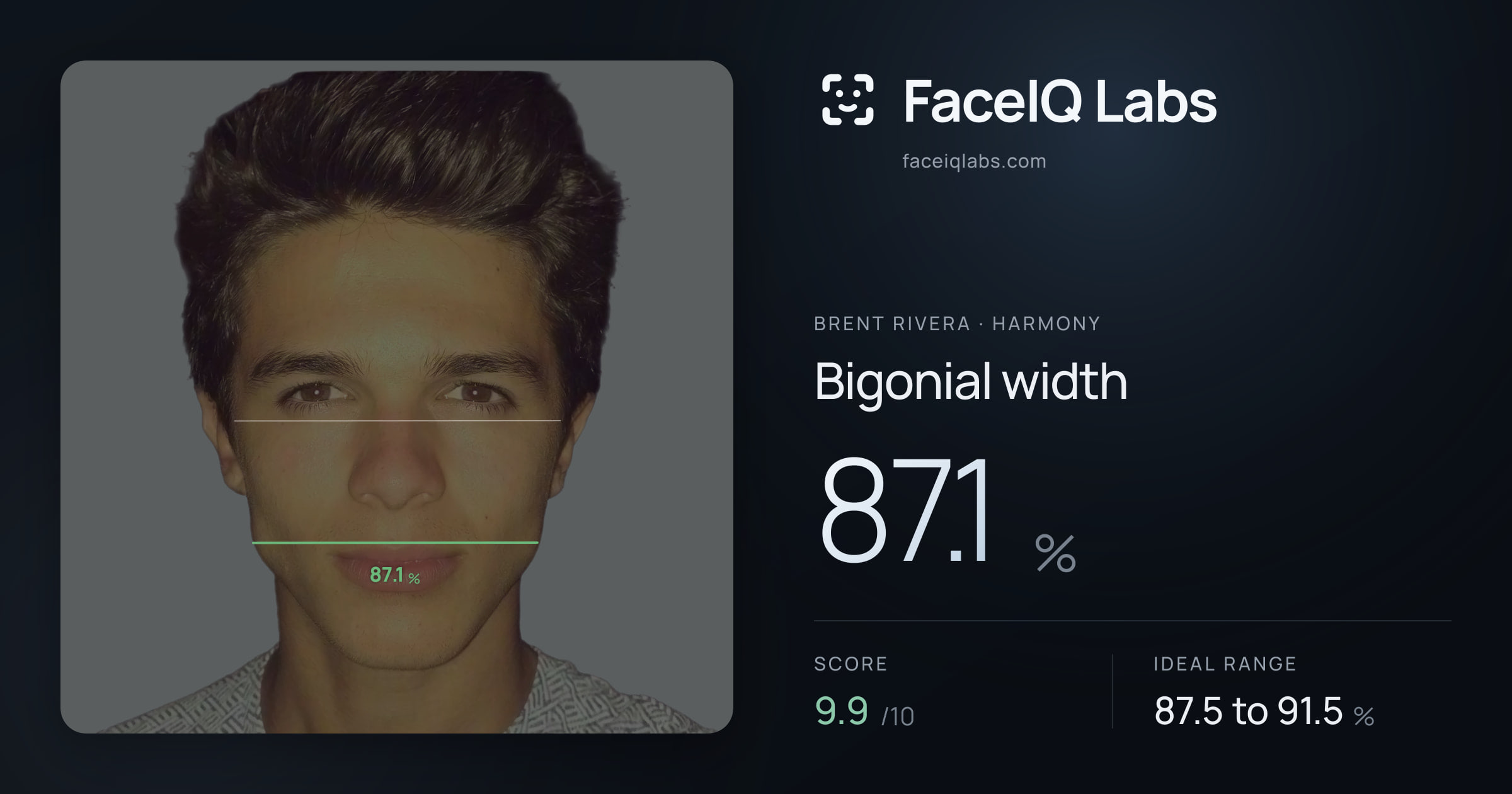 Brent Rivera Bigonial width: 87.1%, drawn on the photo