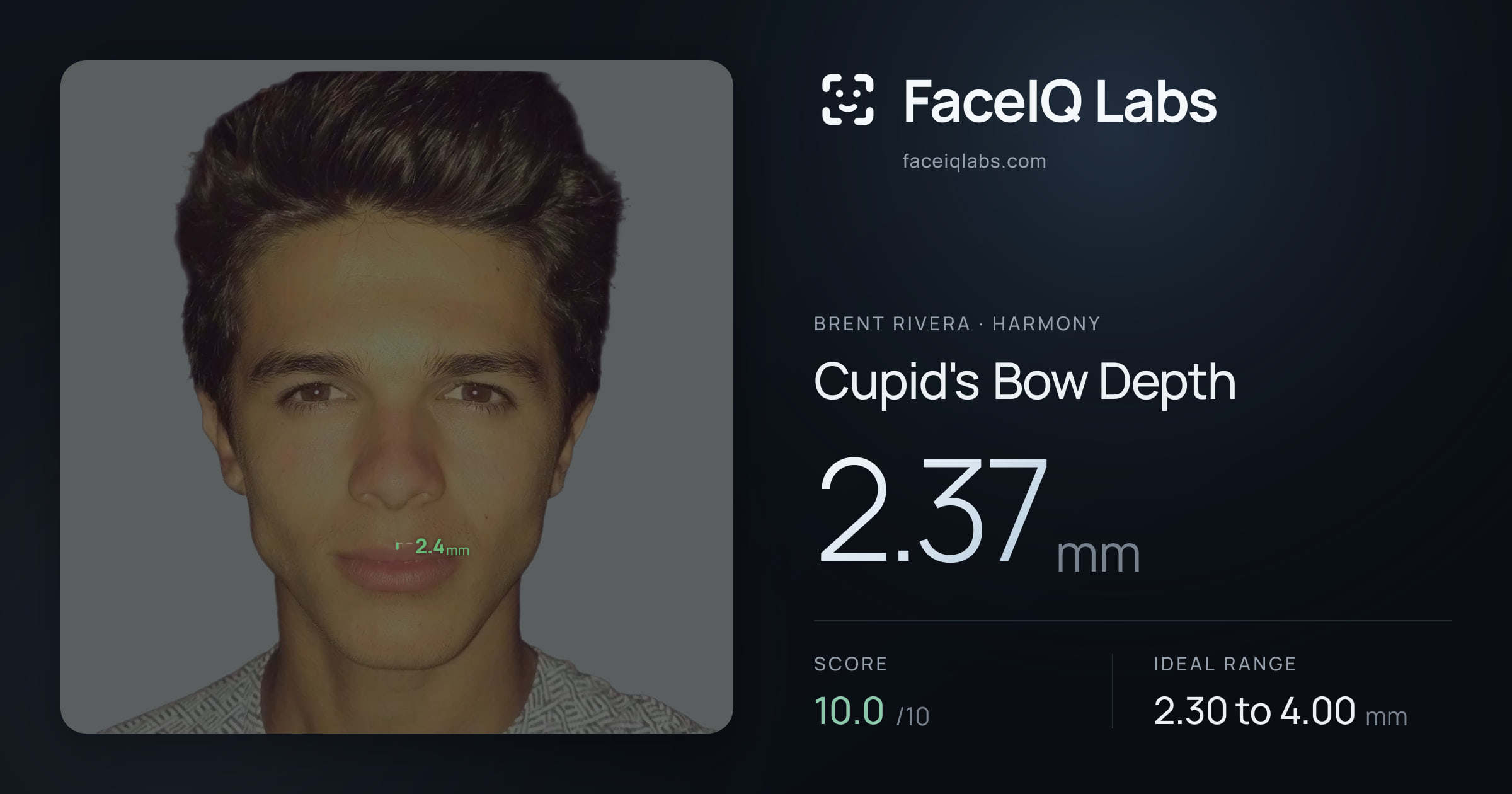 Brent Rivera Cupid's Bow Depth: 2.37mm, drawn on the photo