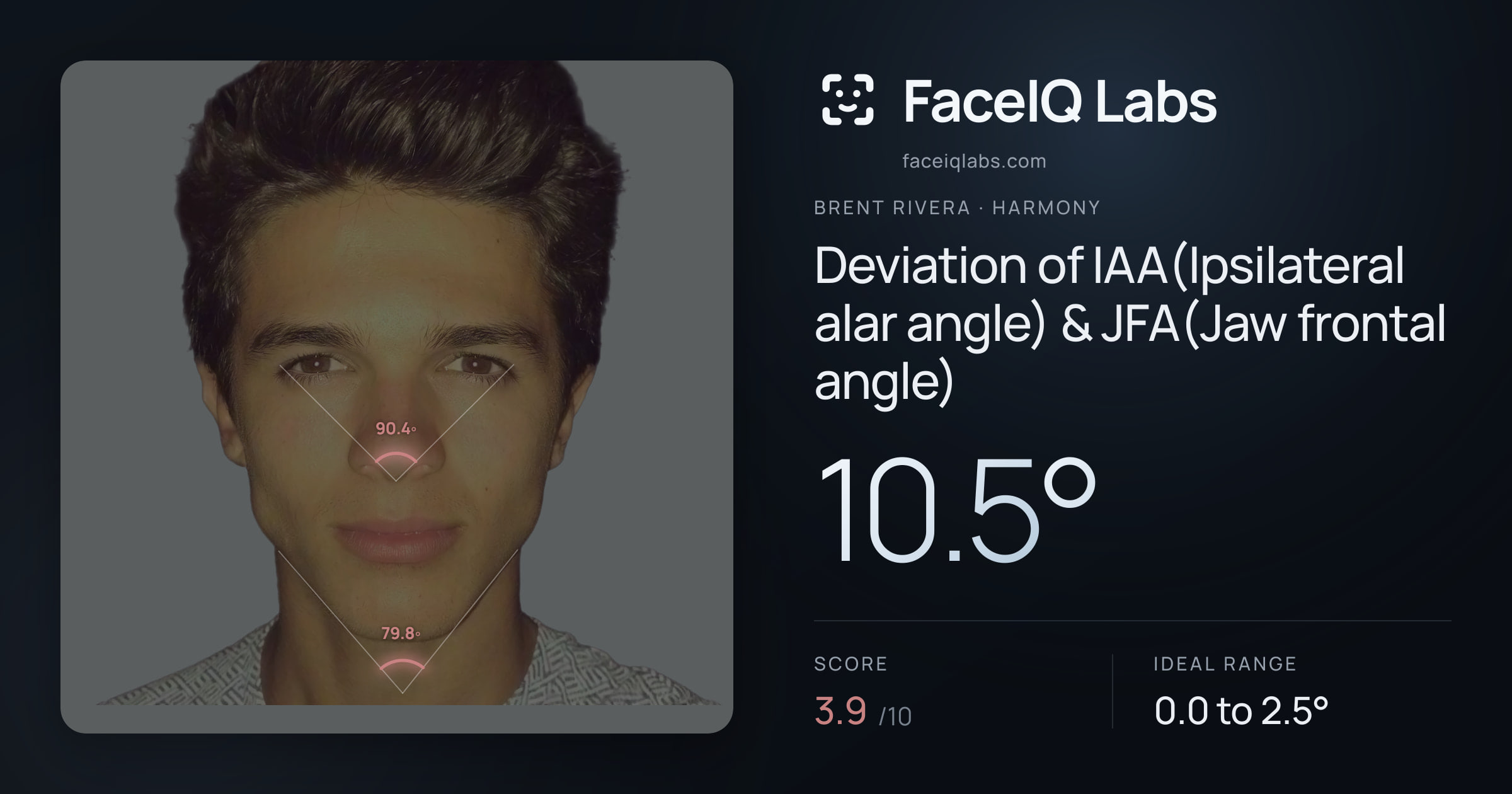Brent Rivera Deviation of IAA(Ipsilateral alar angle) & JFA(Jaw frontal angle): 10.5°, drawn on the photo
