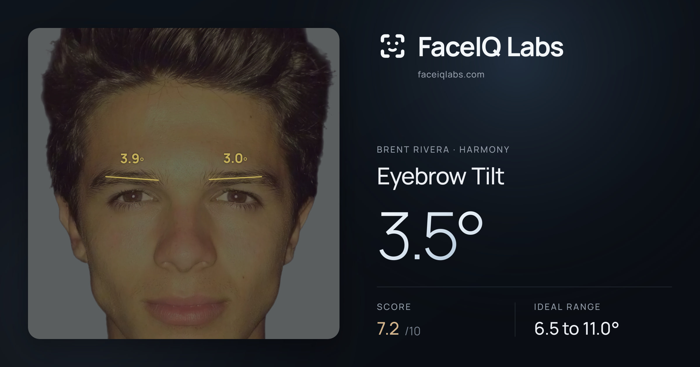 Brent Rivera Eyebrow Tilt: 3.5°, drawn on the photo