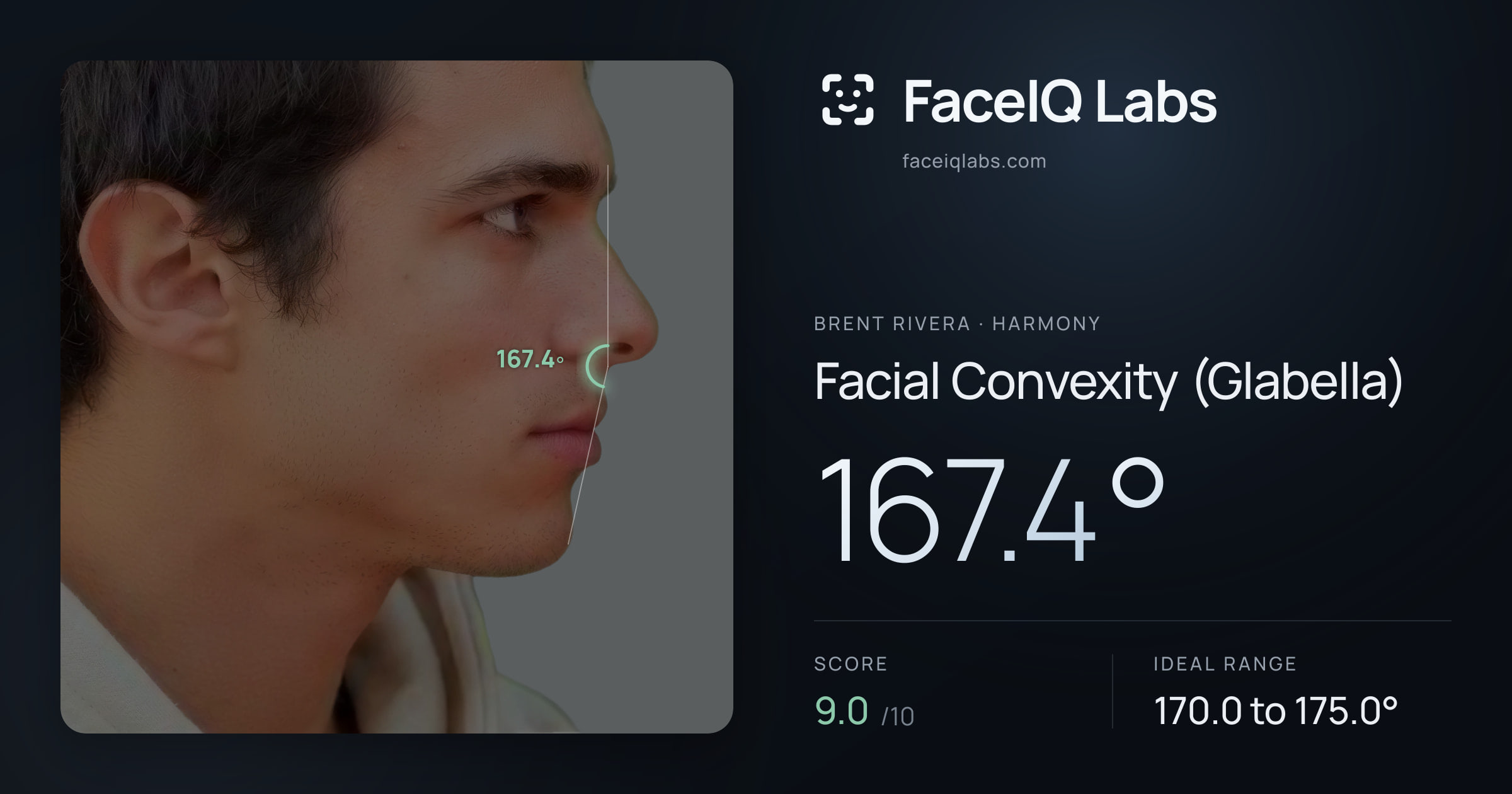 Brent Rivera Facial Convexity (Glabella): 167.4°, drawn on the photo