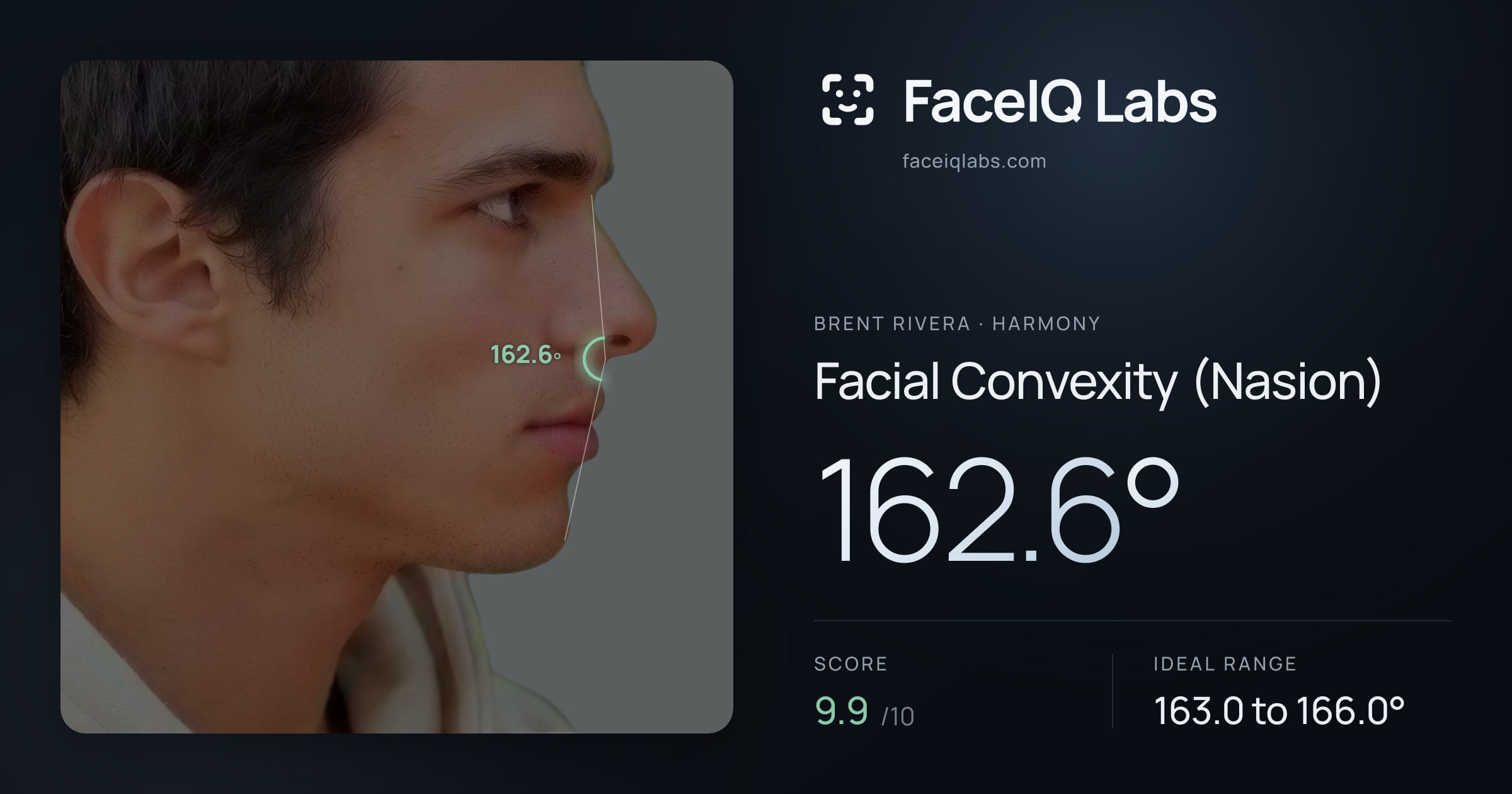 Brent Rivera Facial Convexity (Nasion): 162.6°, drawn on the photo