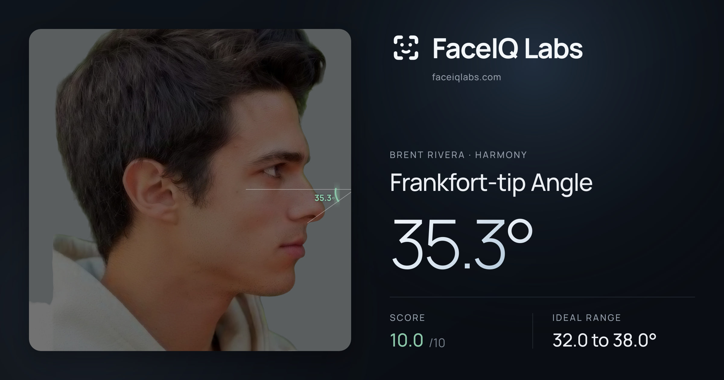 Brent Rivera Frankfort-tip Angle: 35.3°, drawn on the photo