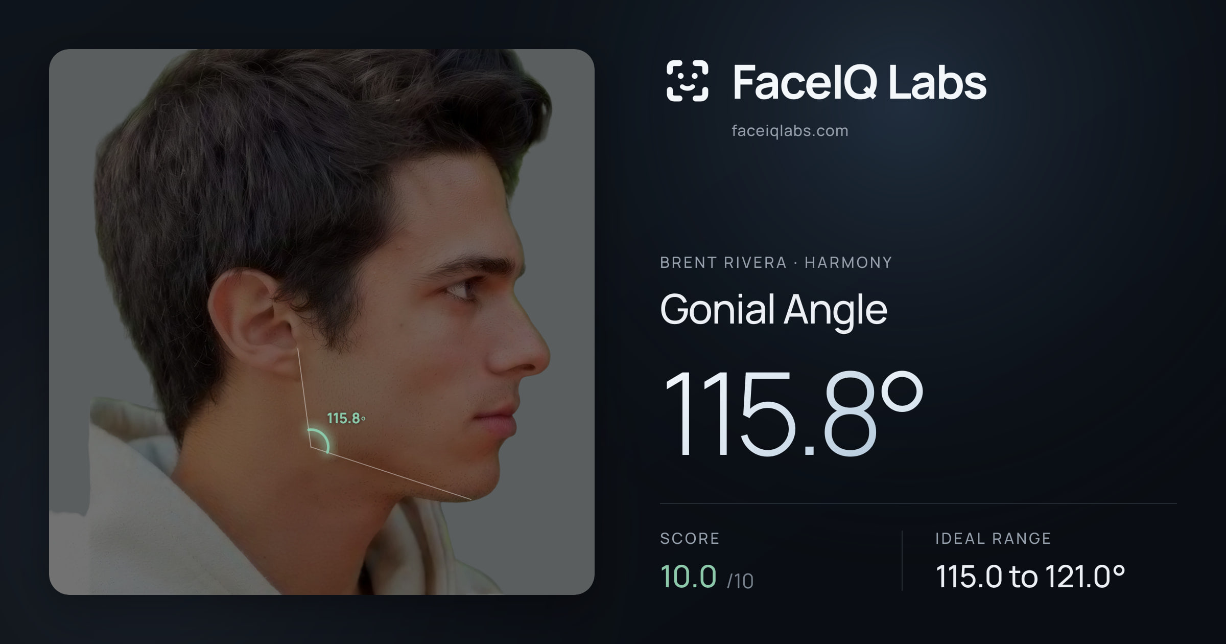 Brent Rivera Gonial Angle: 115.8°, drawn on the photo