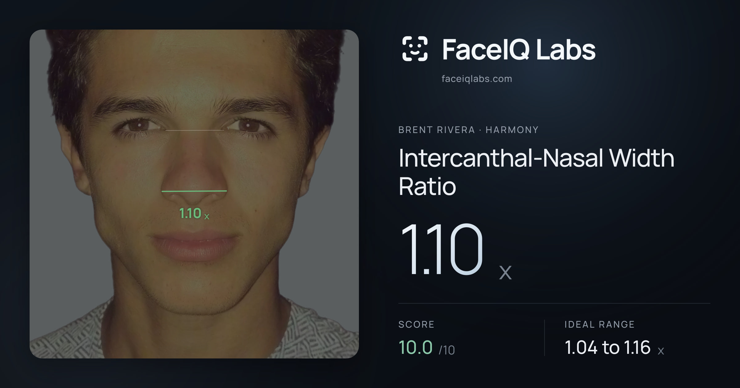 Brent Rivera Intercanthal-Nasal Width Ratio: 1.10x, drawn on the photo