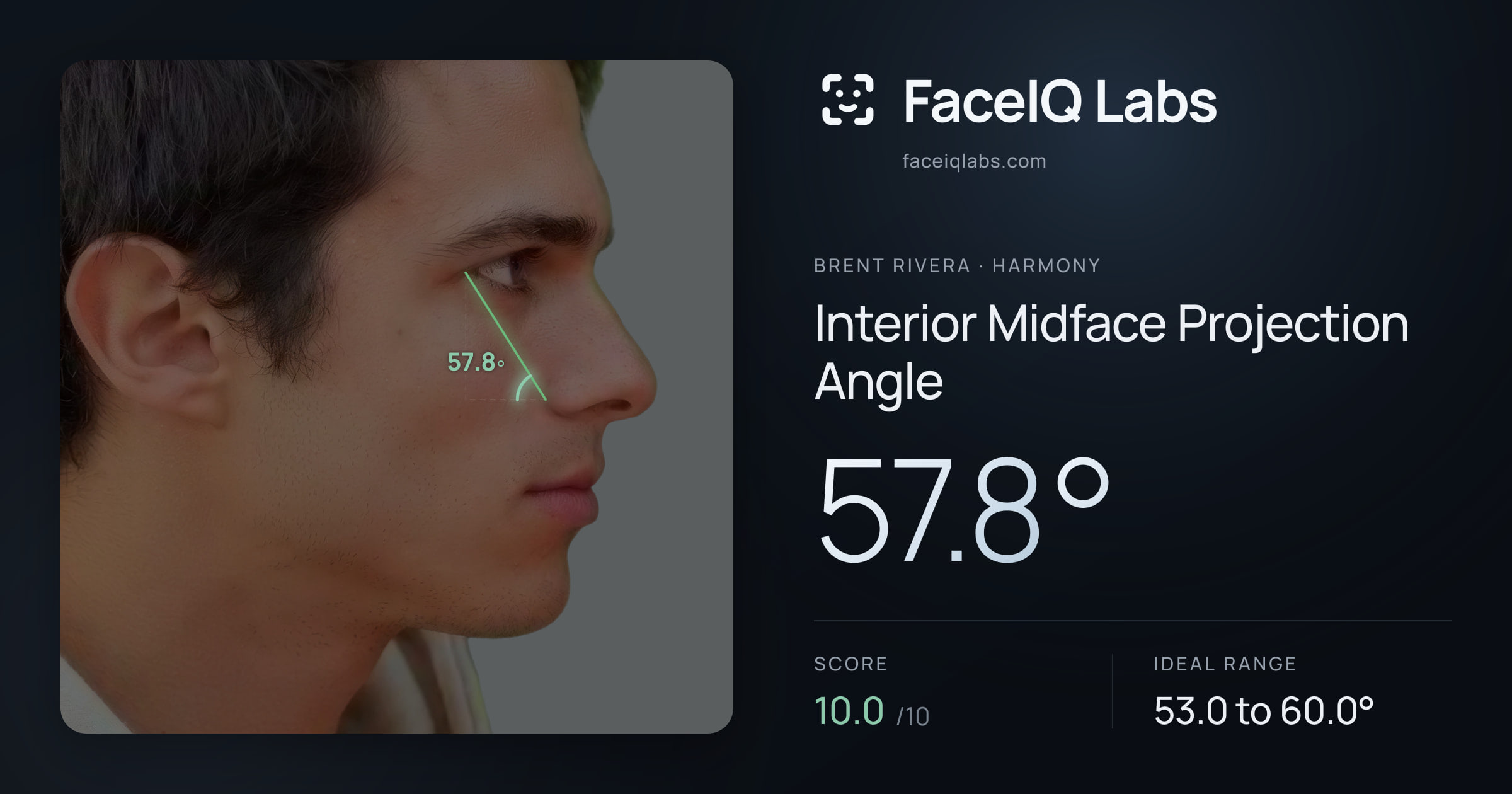 Brent Rivera Interior Midface Projection Angle: 57.8°, drawn on the photo