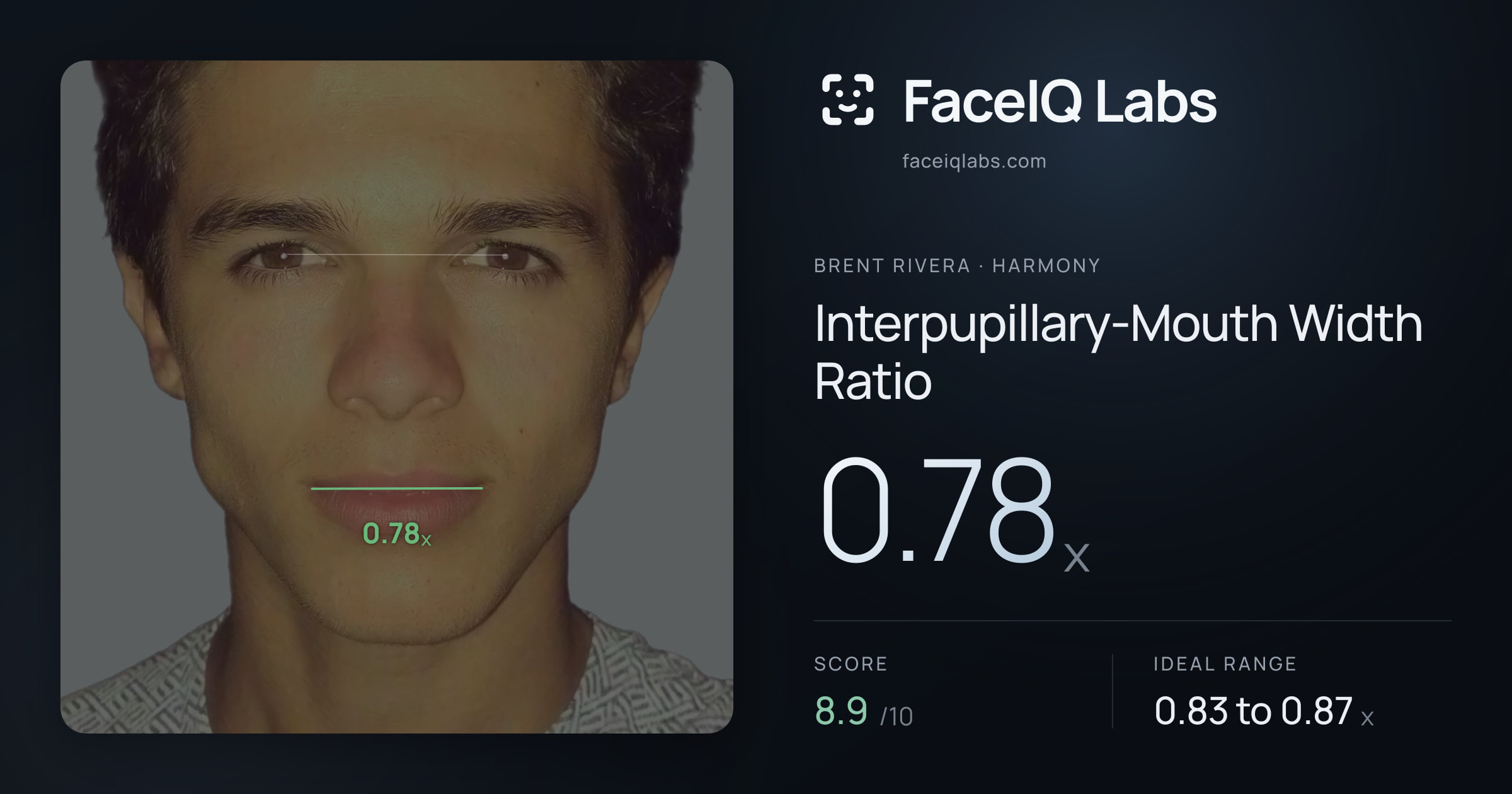 Brent Rivera Interpupillary-Mouth Width Ratio: 0.78x, drawn on the photo